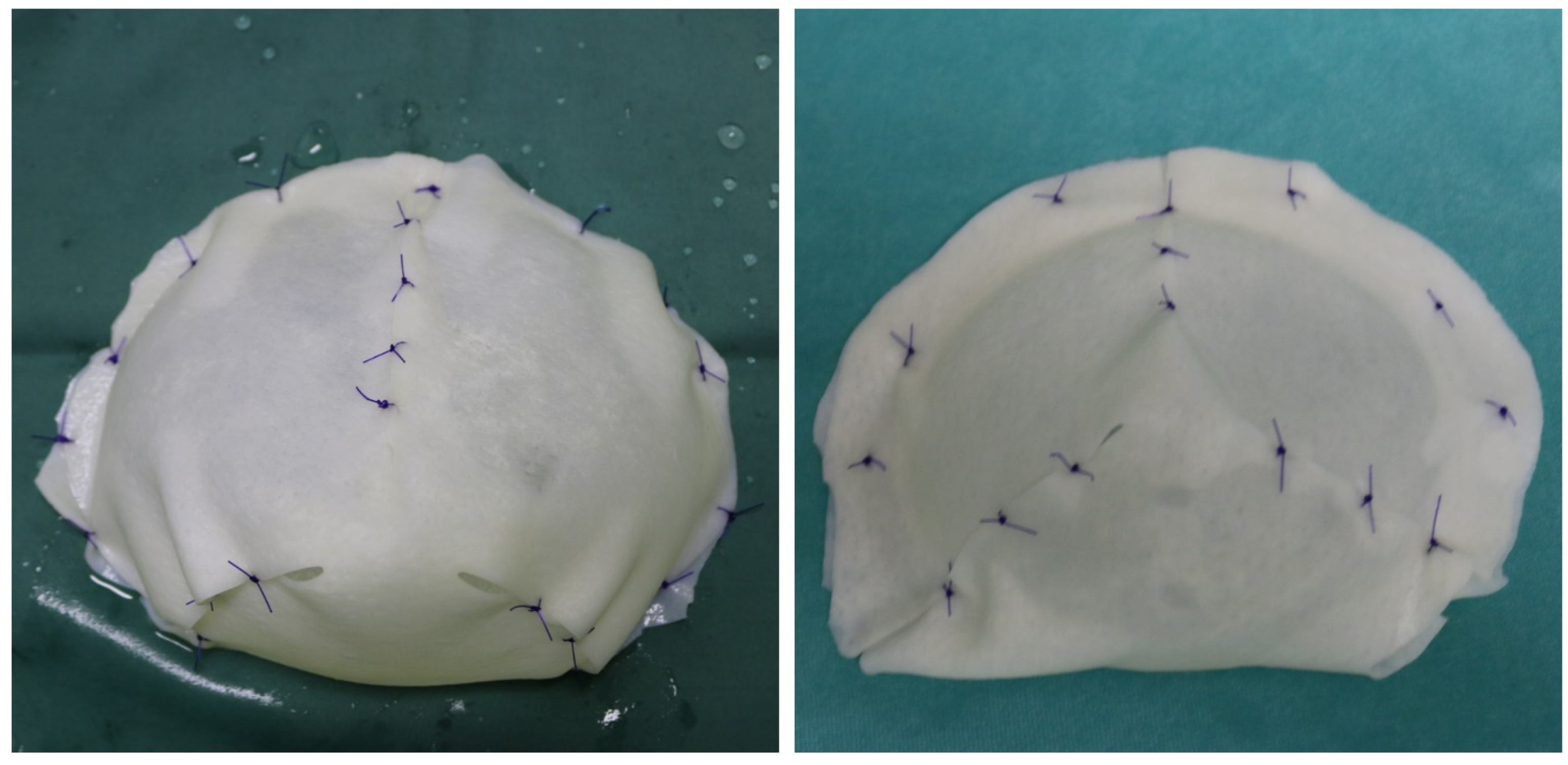 Medicina 58 00992 g006 550