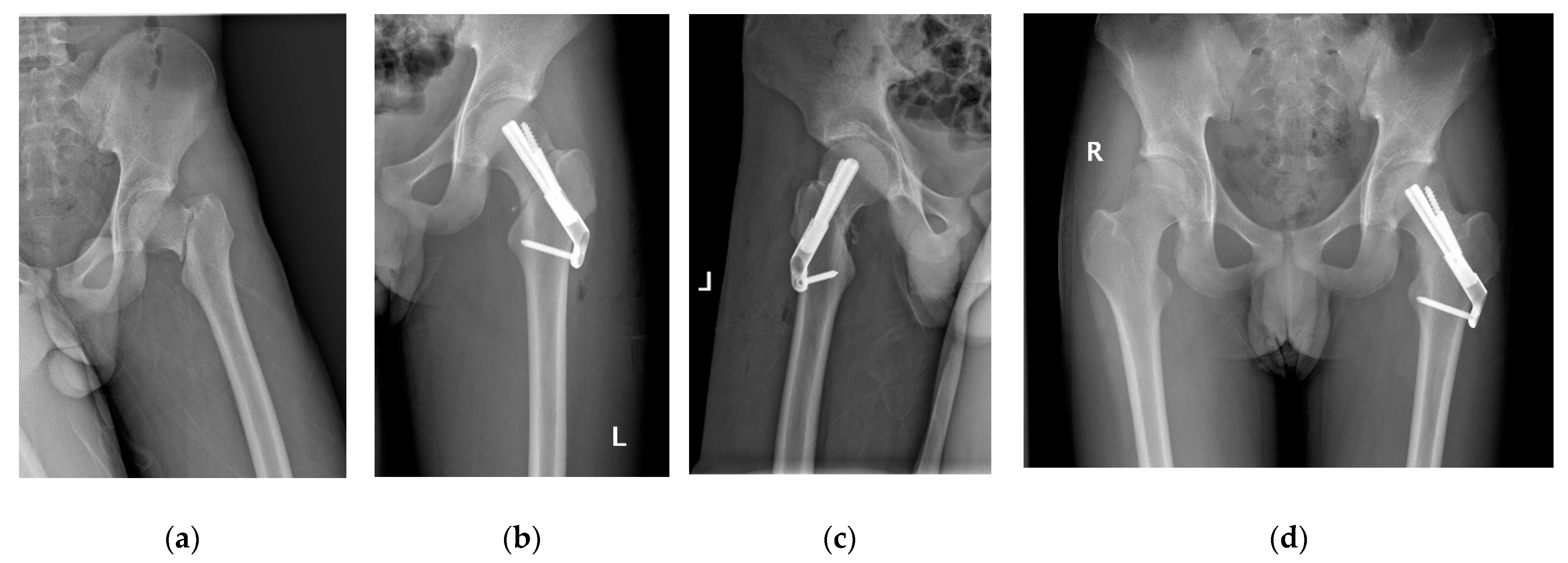Medicina 58 00999 g002 550