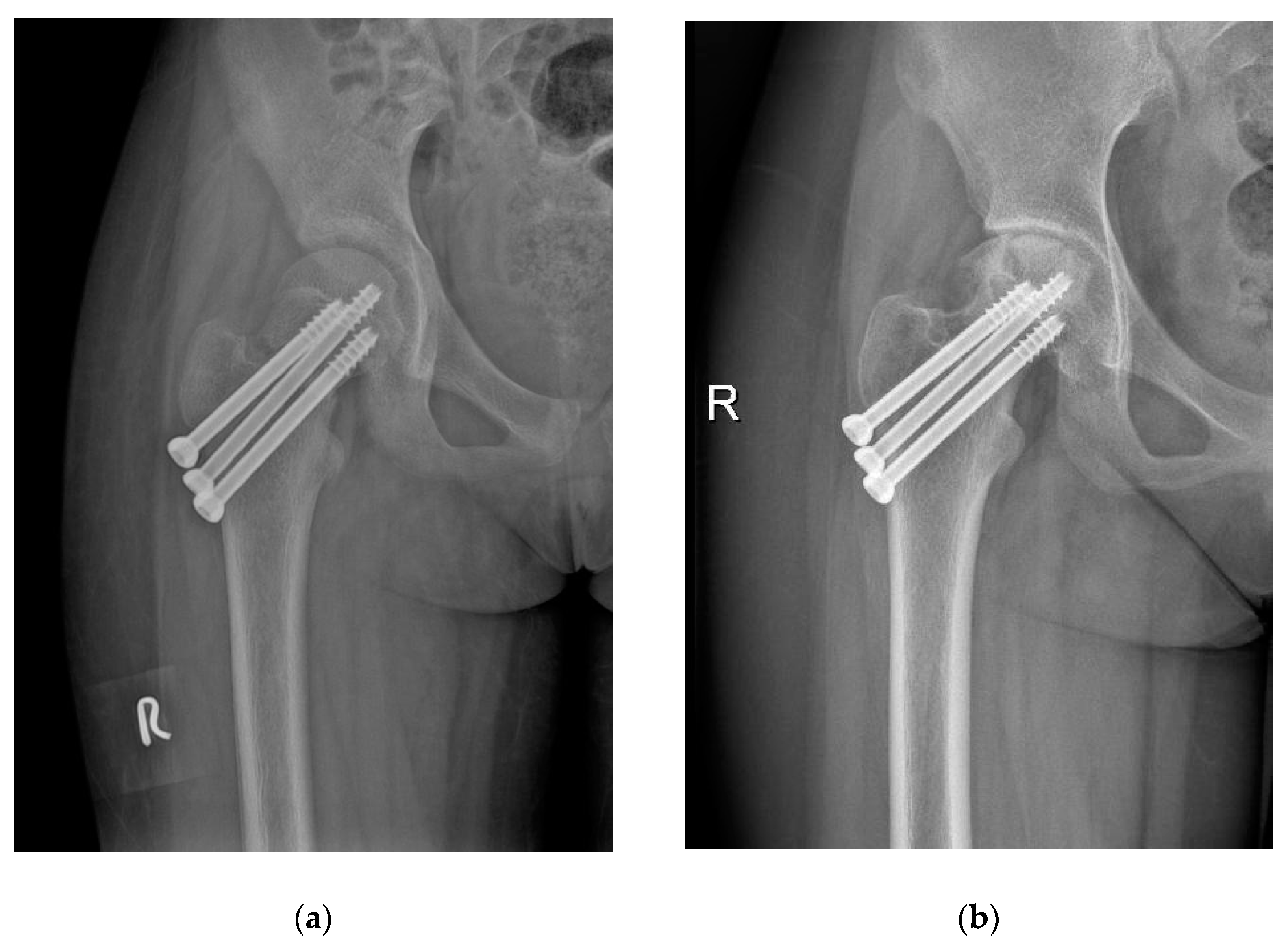 Medicina 58 00999 g004 550