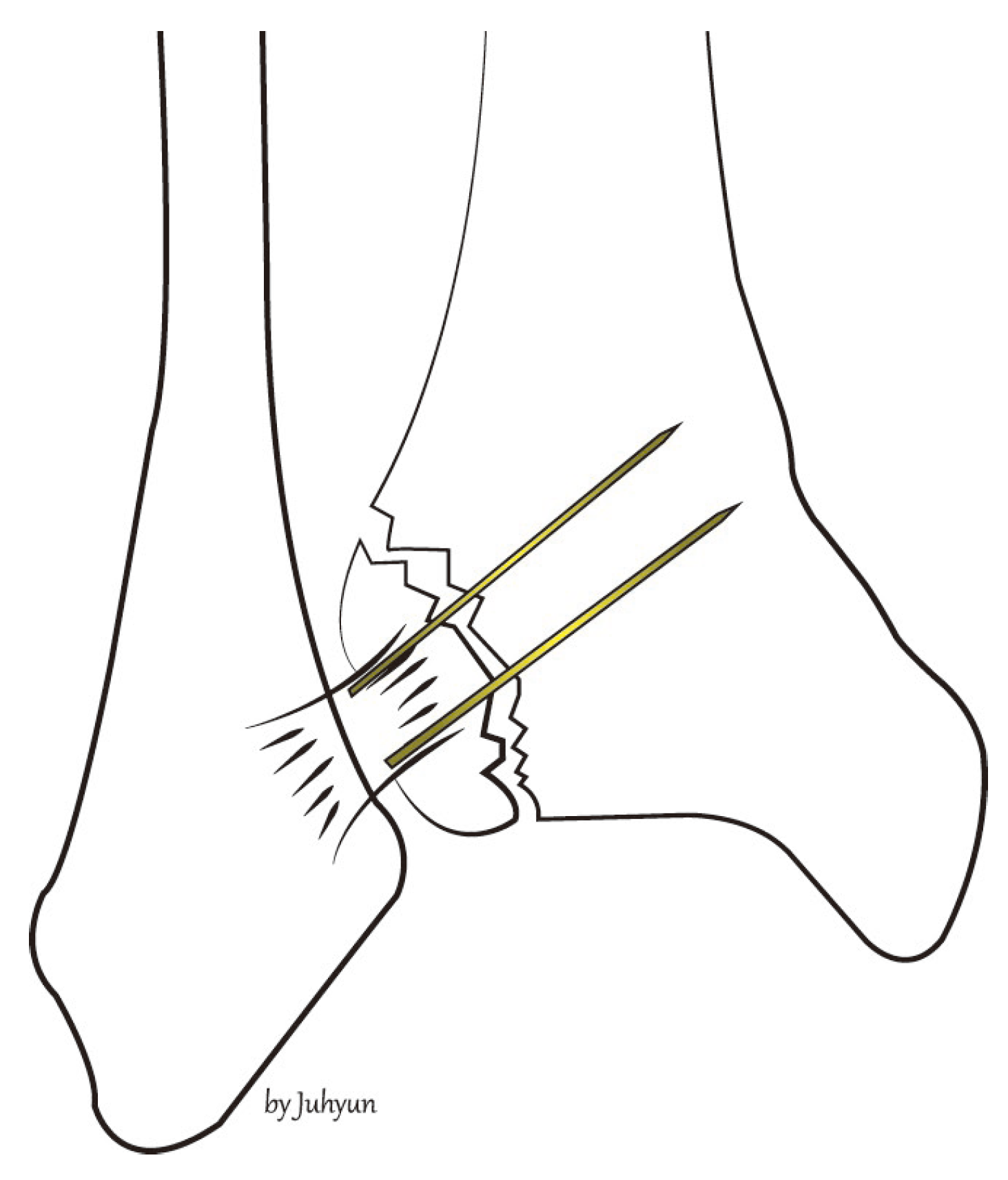 Medicina 58 01005 g002 550