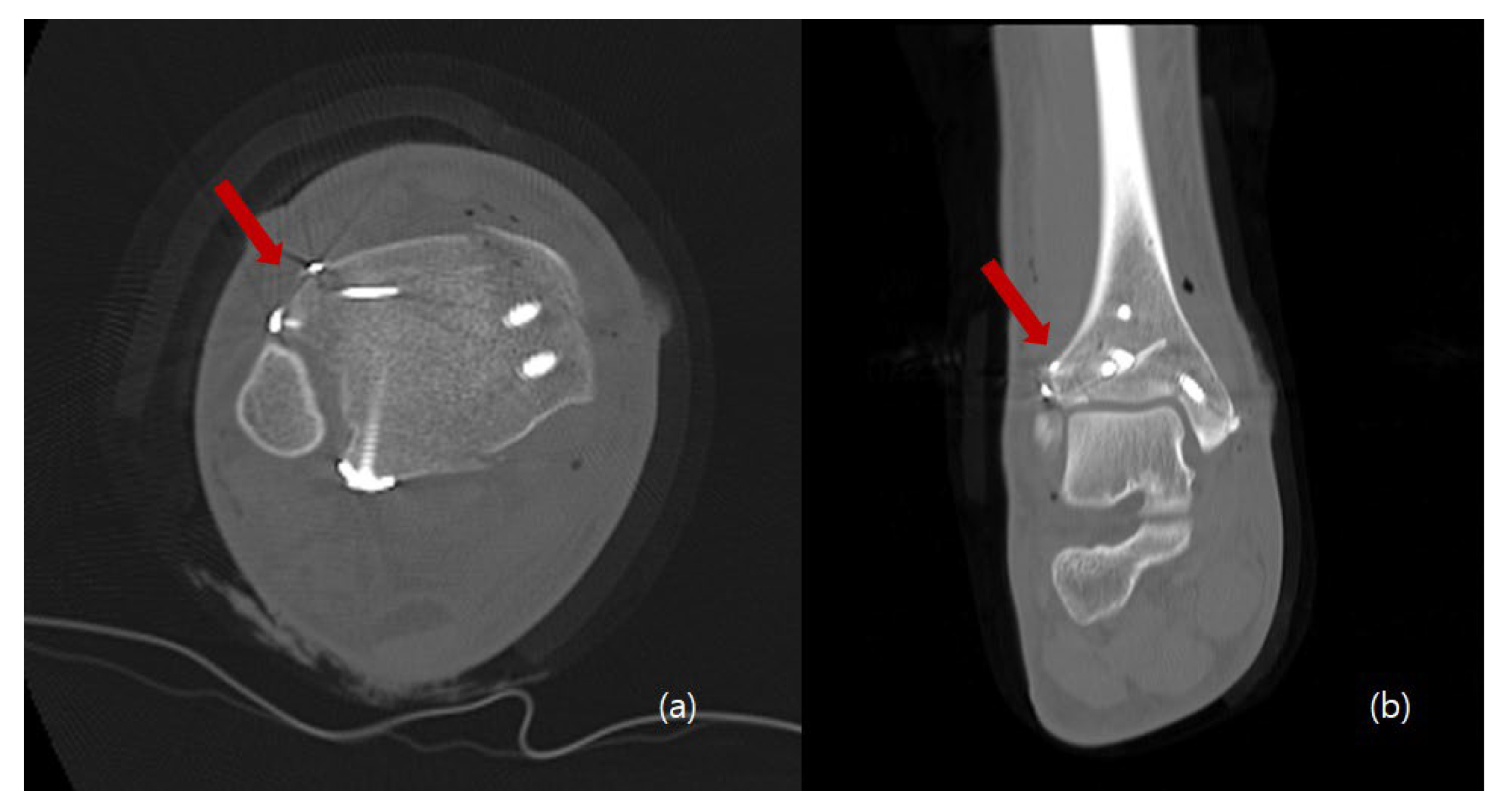 Medicina 58 01005 g005 550