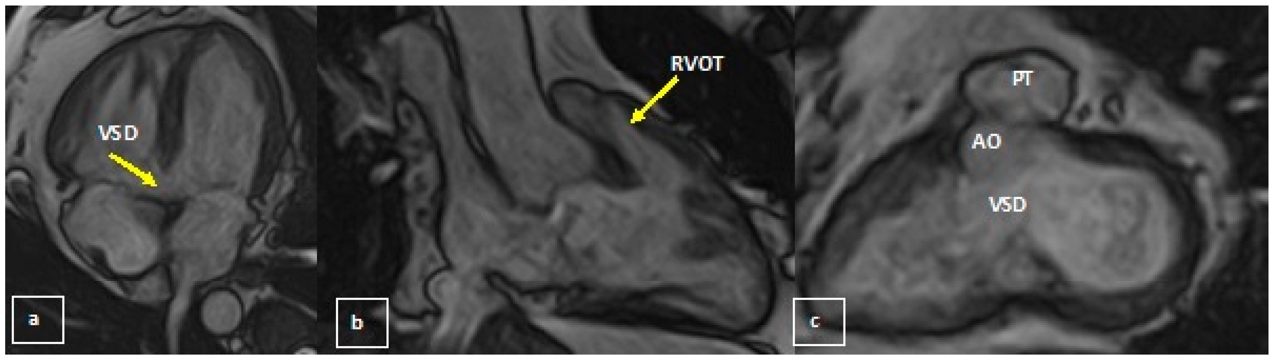 Medicina 58 01011 g002 550