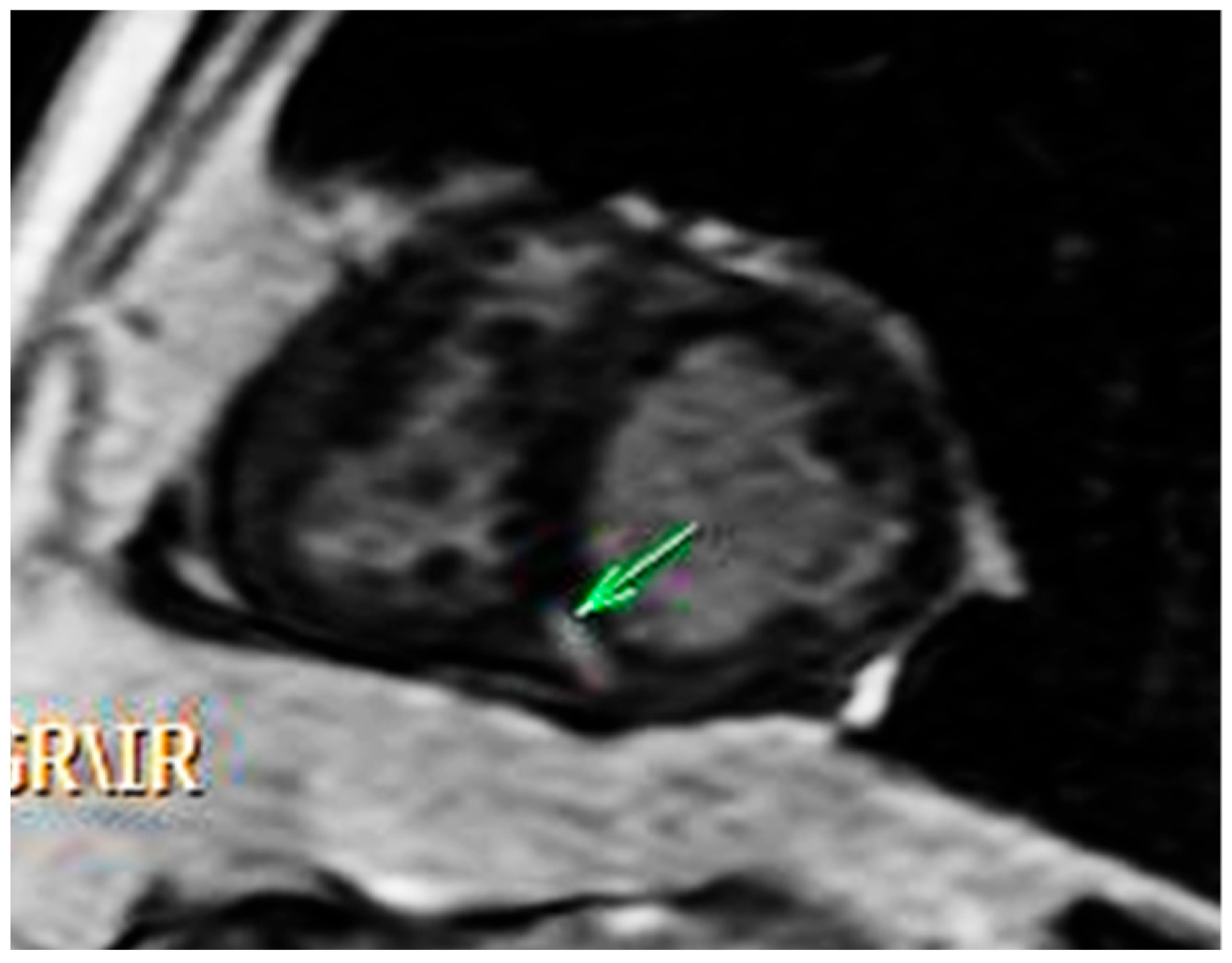 Medicina 58 01011 g003 550