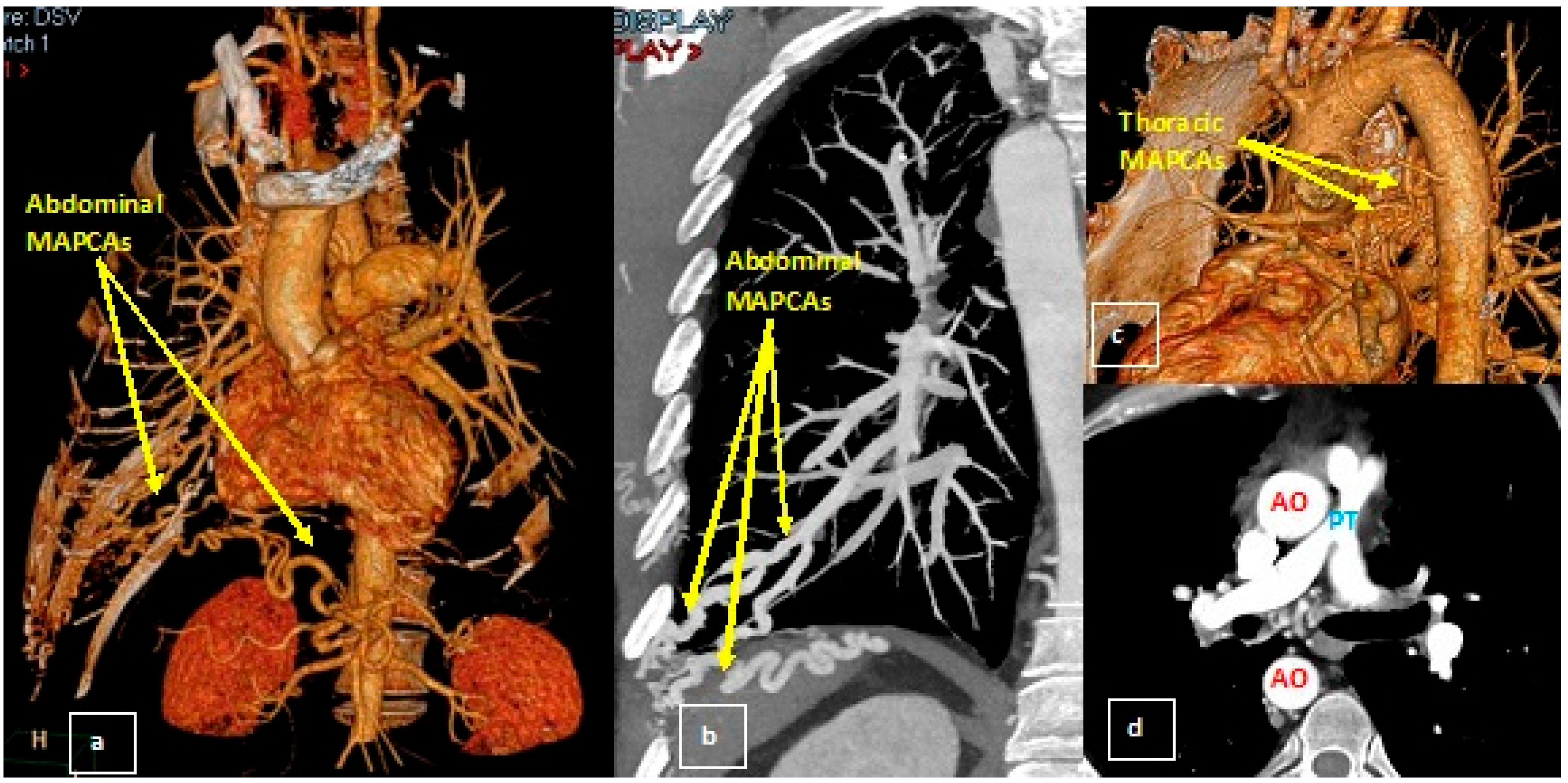 Medicina 58 01011 g004 550