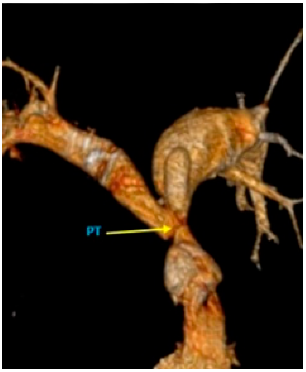 Medicina 58 01011 g005 550