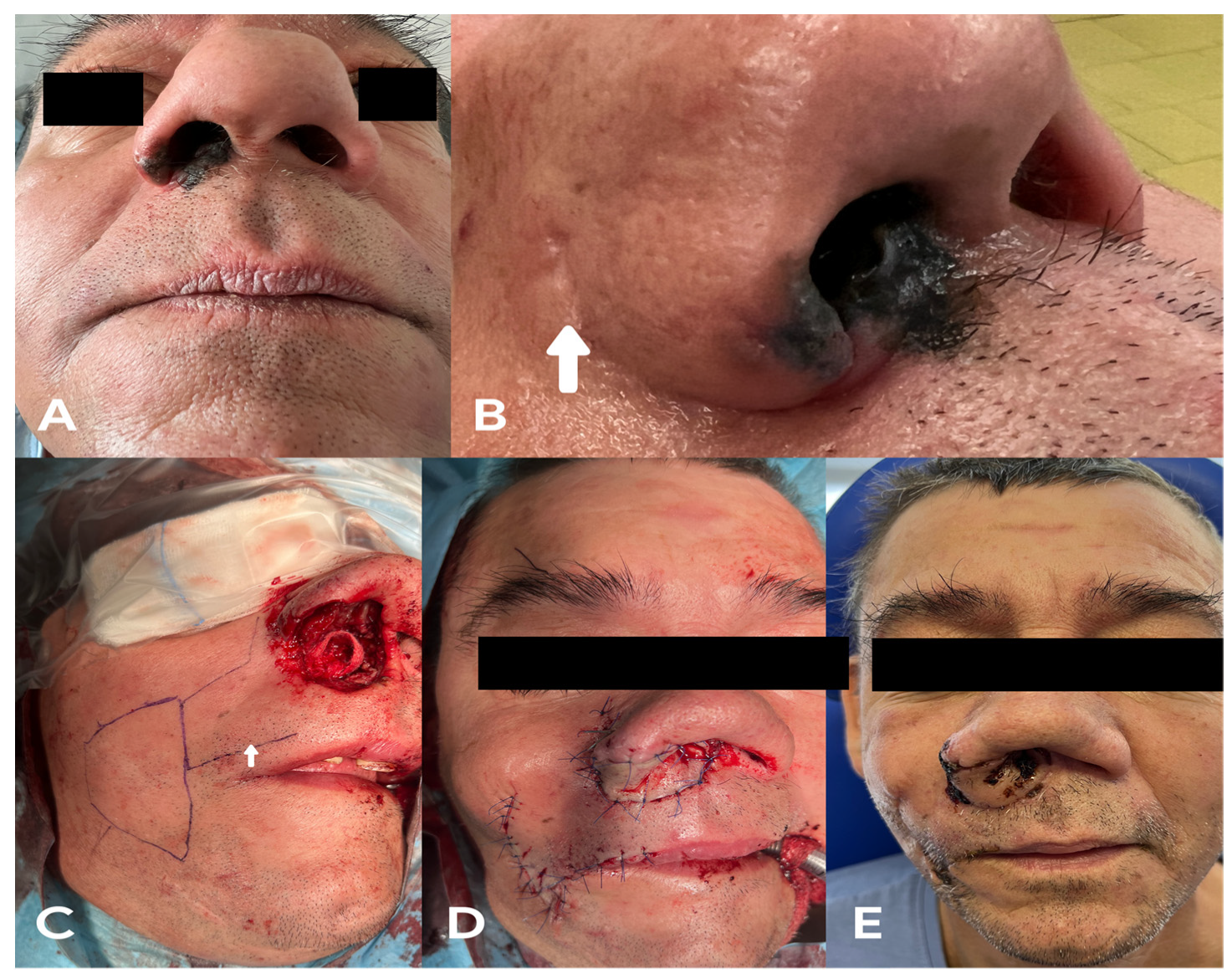 Medicina 58 01012 g005