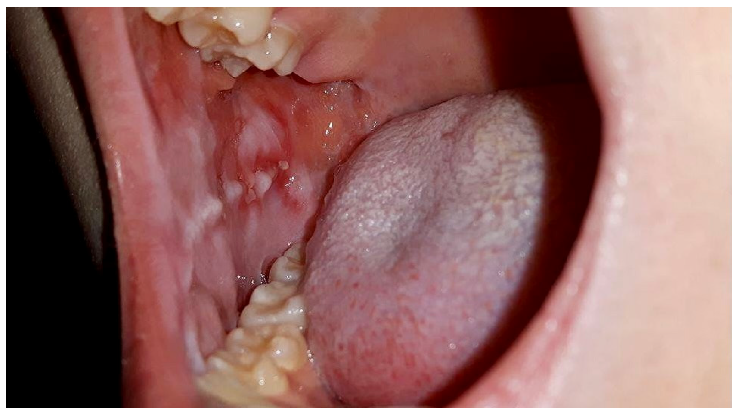 Medicina 58 01023 g001 550