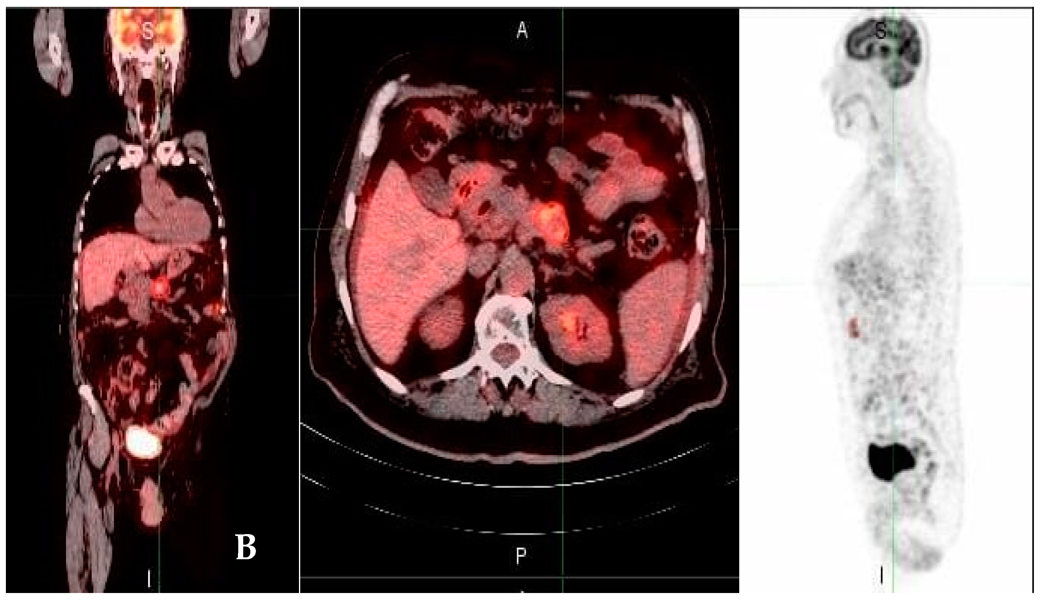 Medicina 58 01027 g001