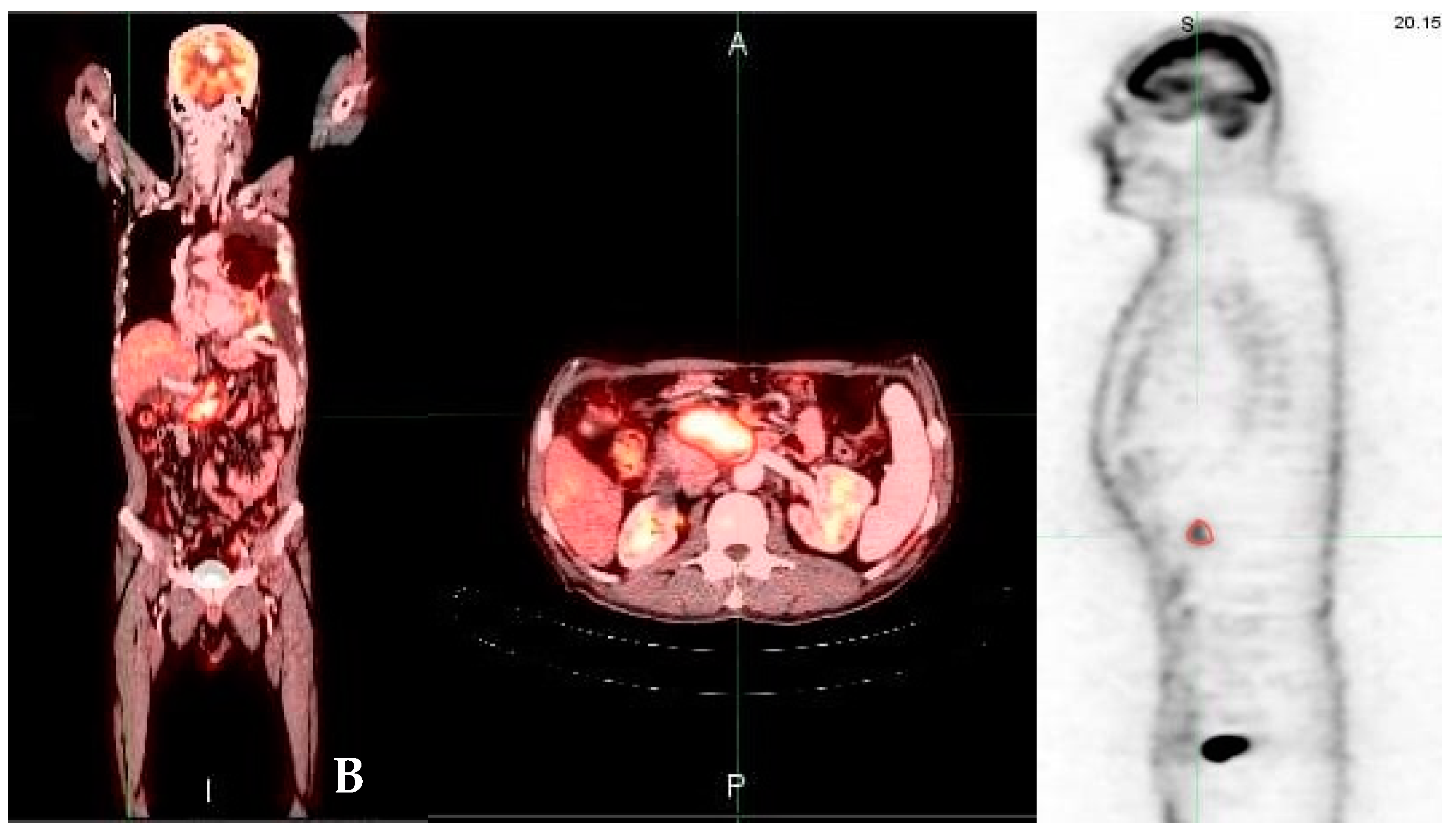 Medicina 58 01027 g002
