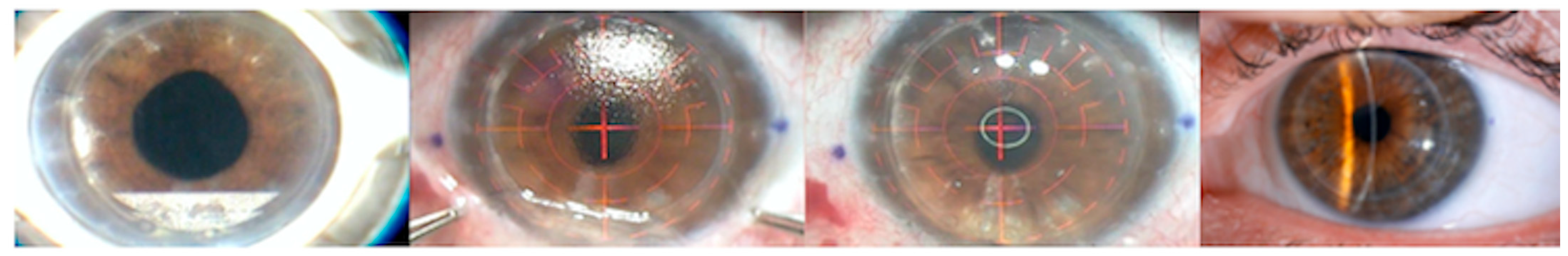 Medicina 58 01036 g001