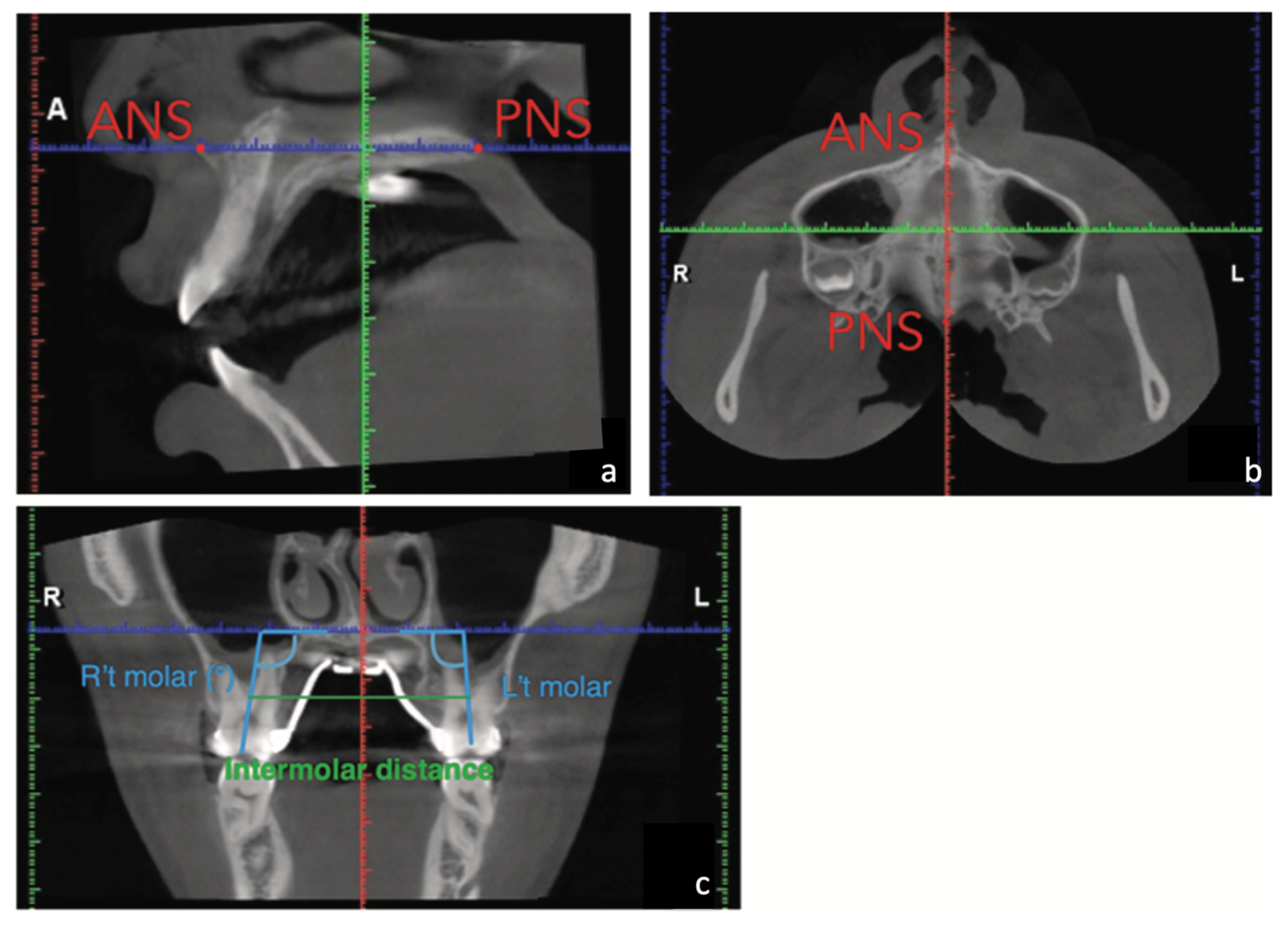Medicina 58 01052 g004