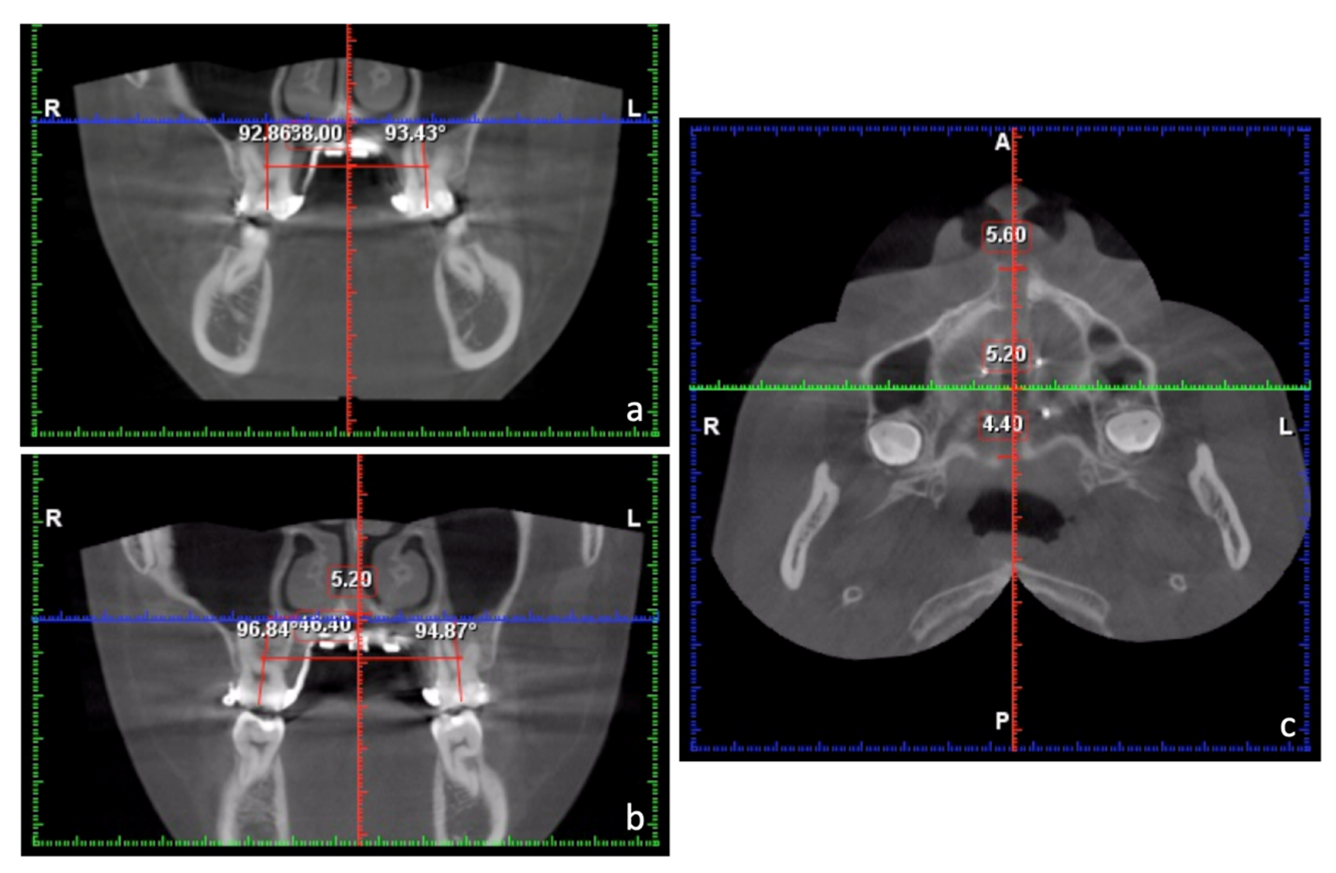 Medicina 58 01052 g005