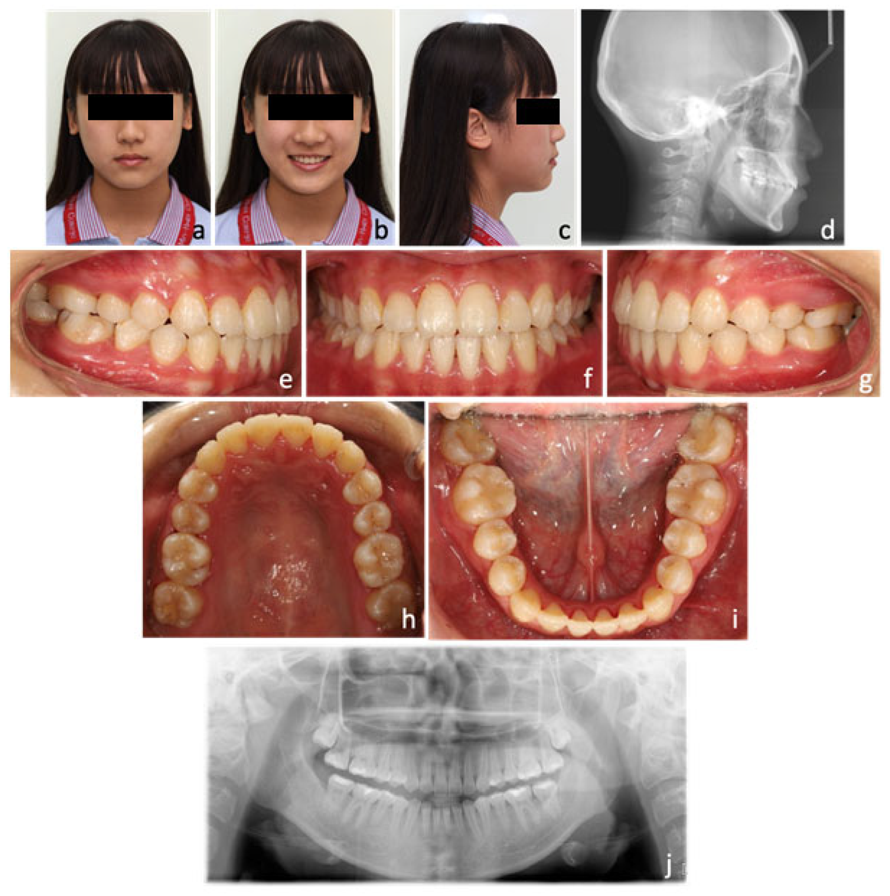 Medicina 58 01052 g006
