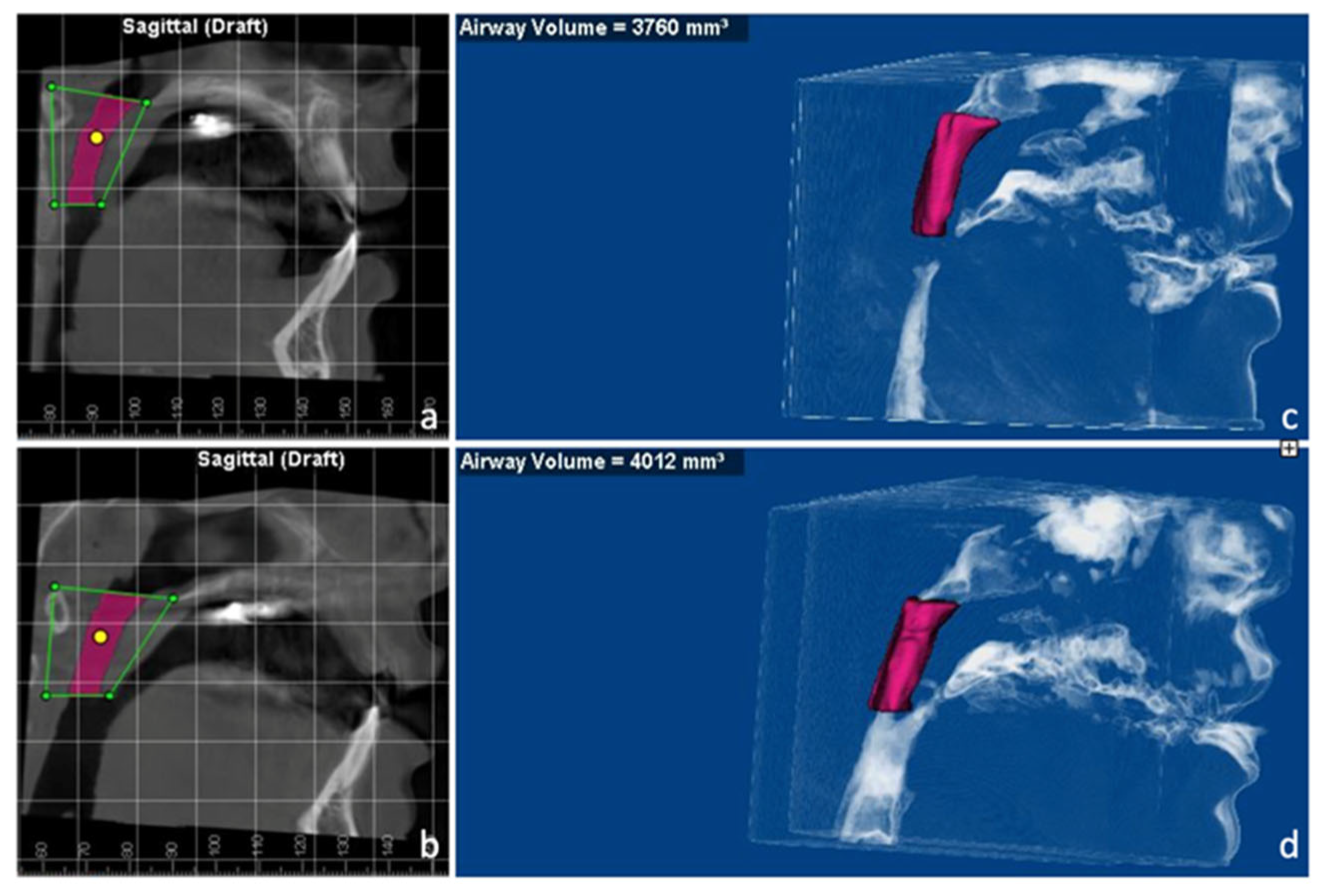 Medicina 58 01052 g008