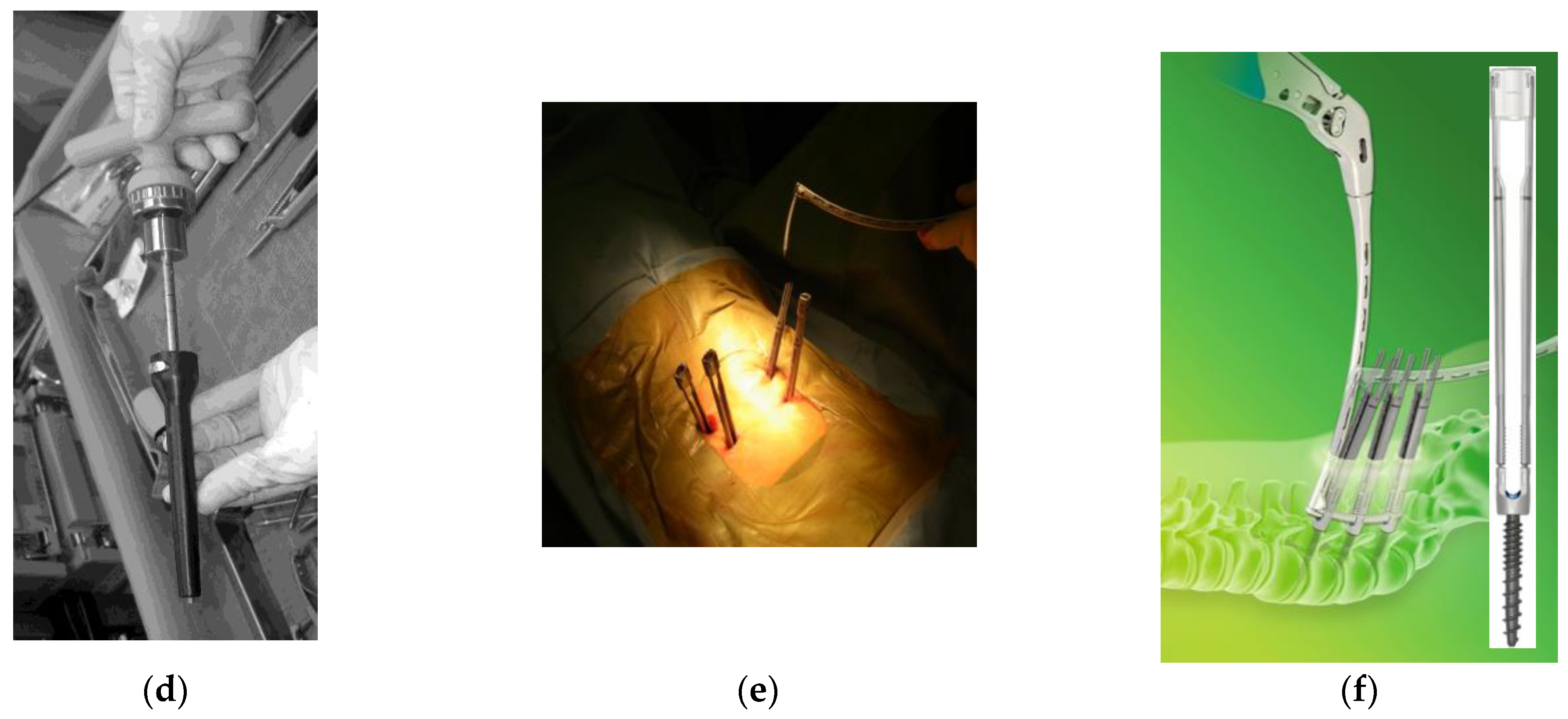 Medicina 58 01064 g002b 550