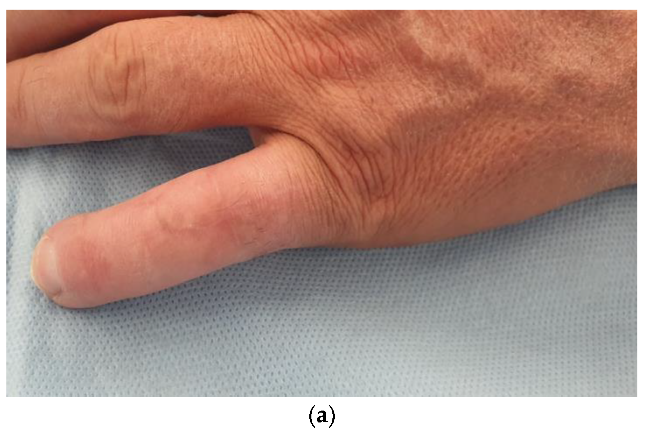 Medicina 58 01065 g004a 550