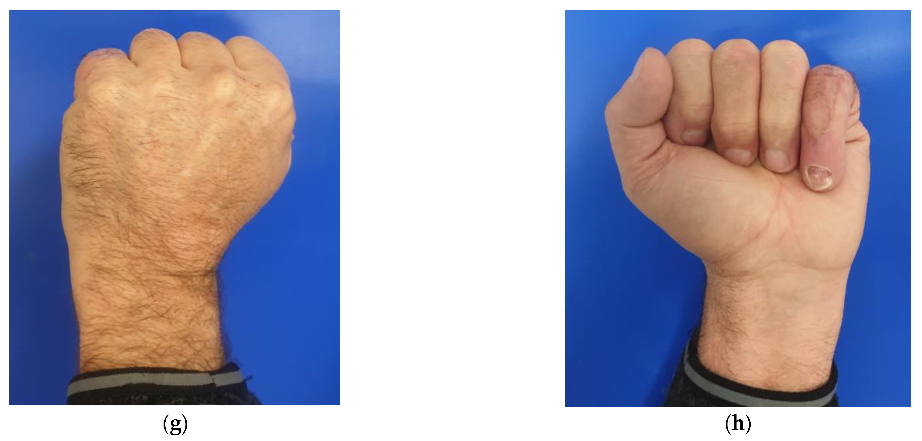 Medicina 58 01065 g004c 550