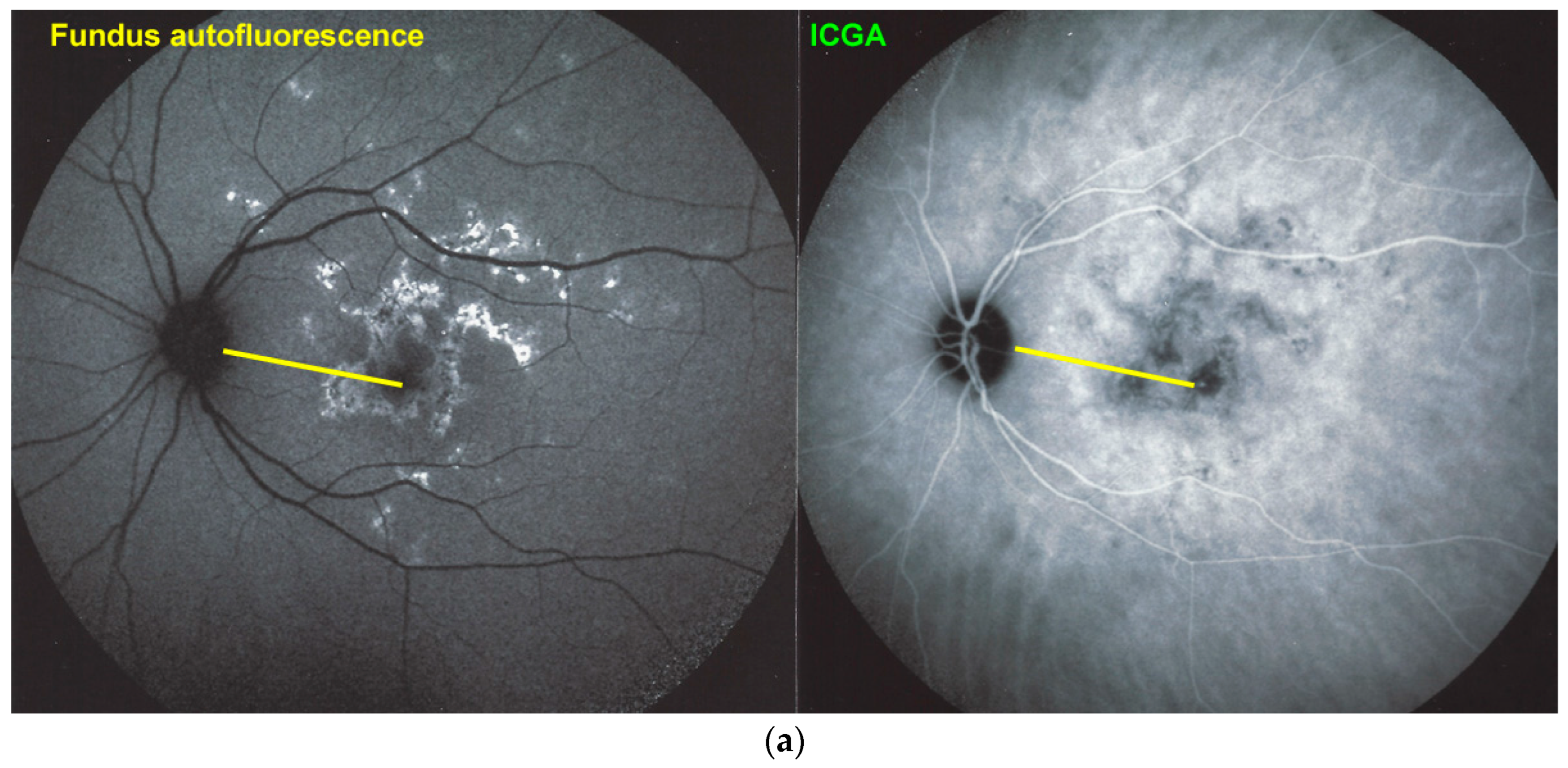 Medicina 58 01070 g007a 550