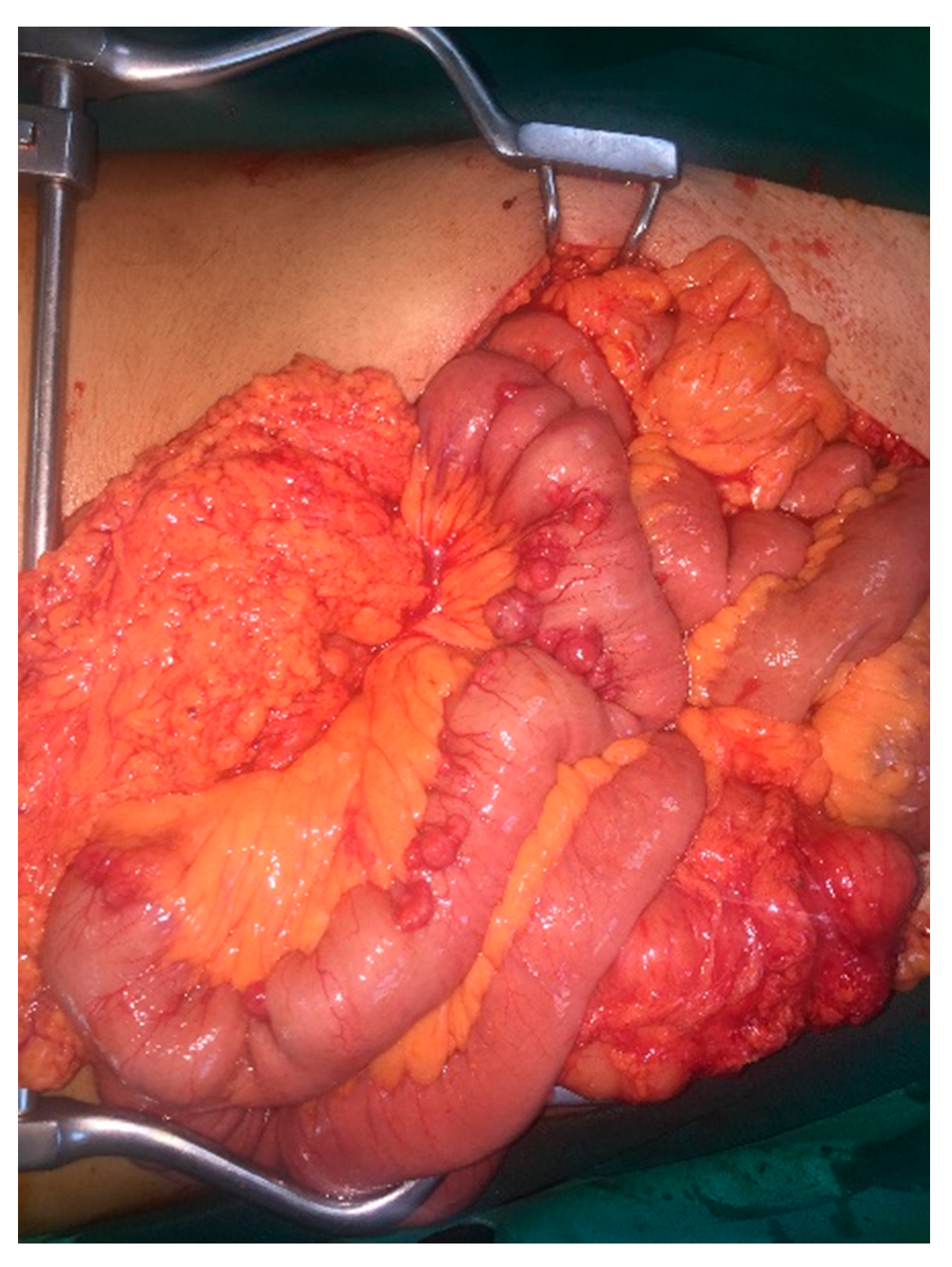 Medicina 58 01116 g001