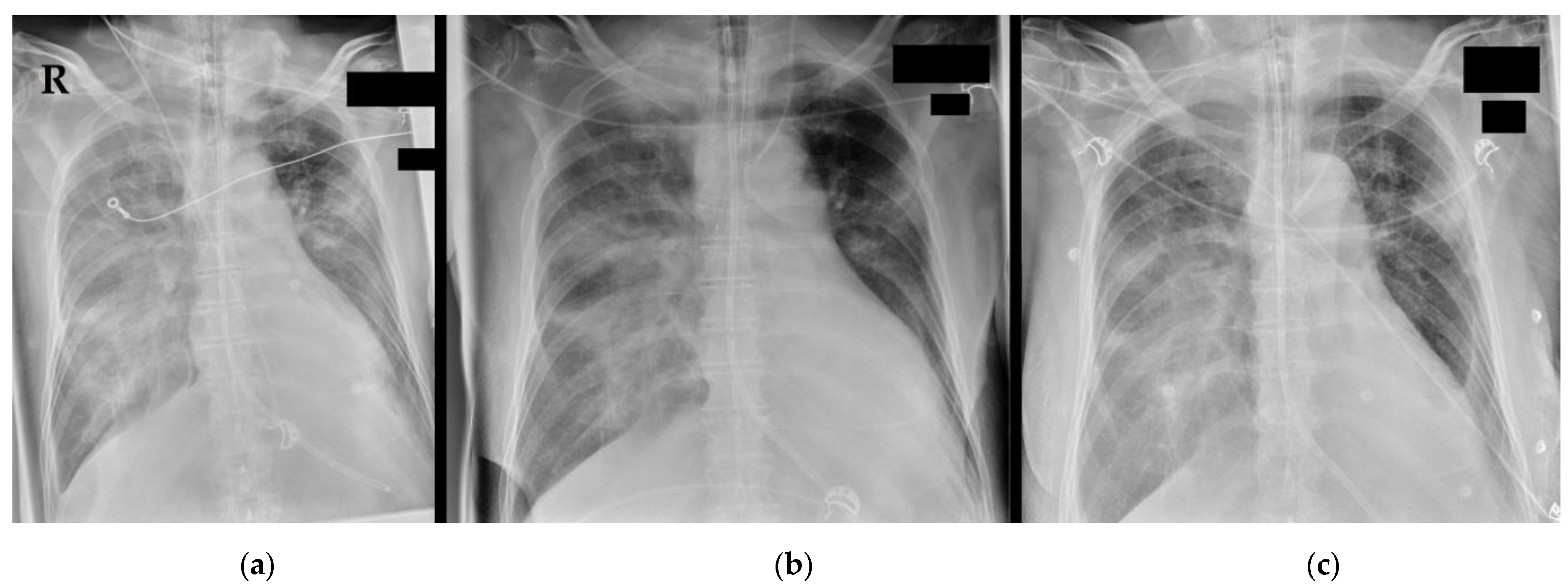 Medicina 58 01121 g001 Medicina 58 01121 g001