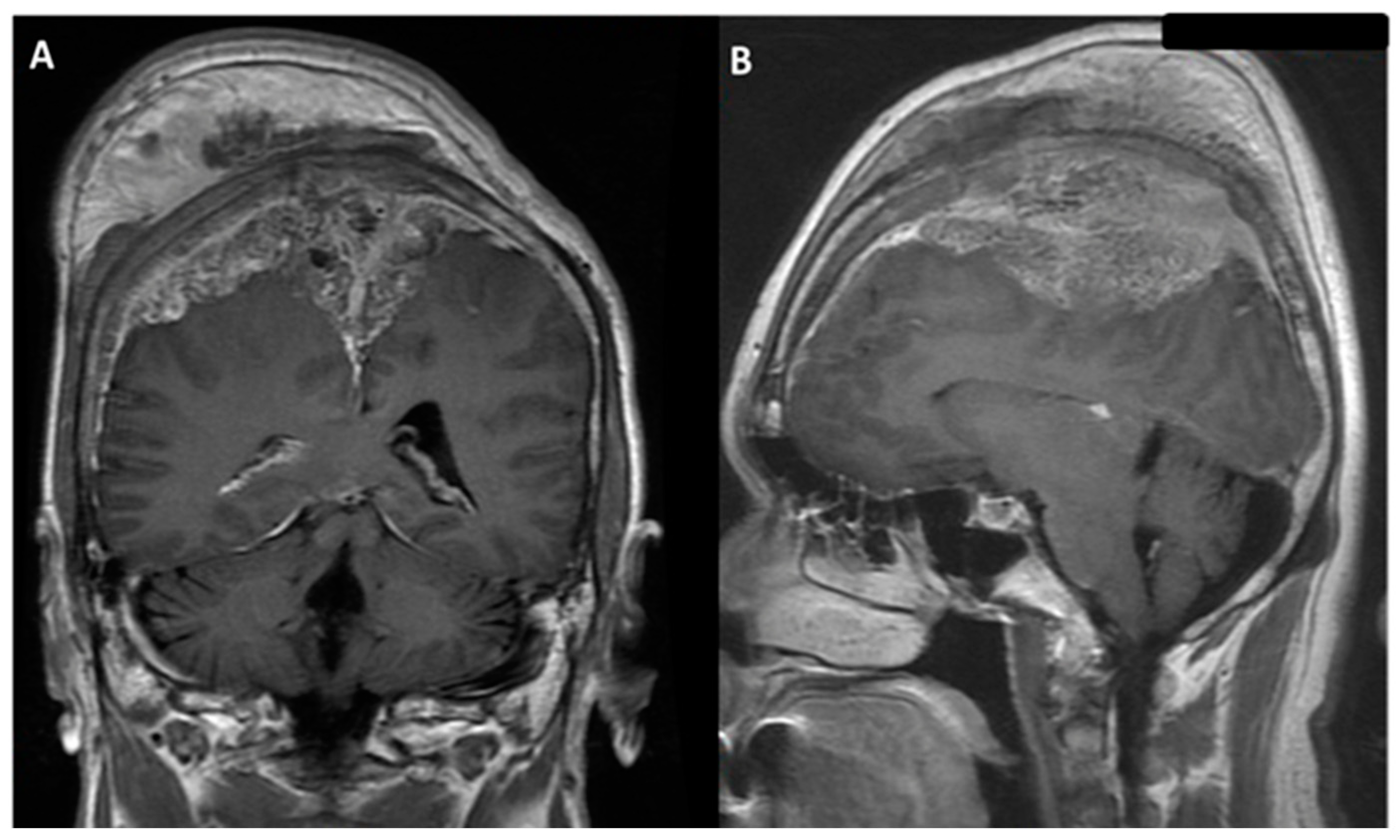 Medicina 58 01126 g002
