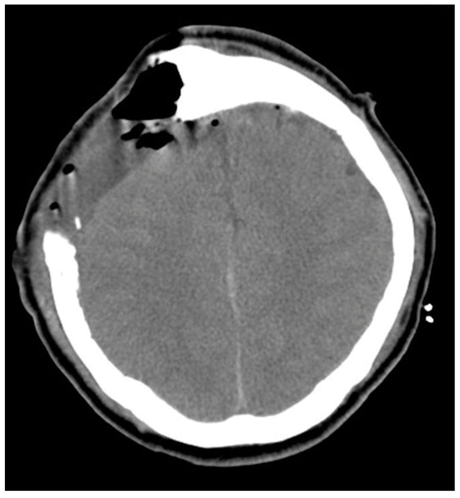 Medicina 58 01126 g003