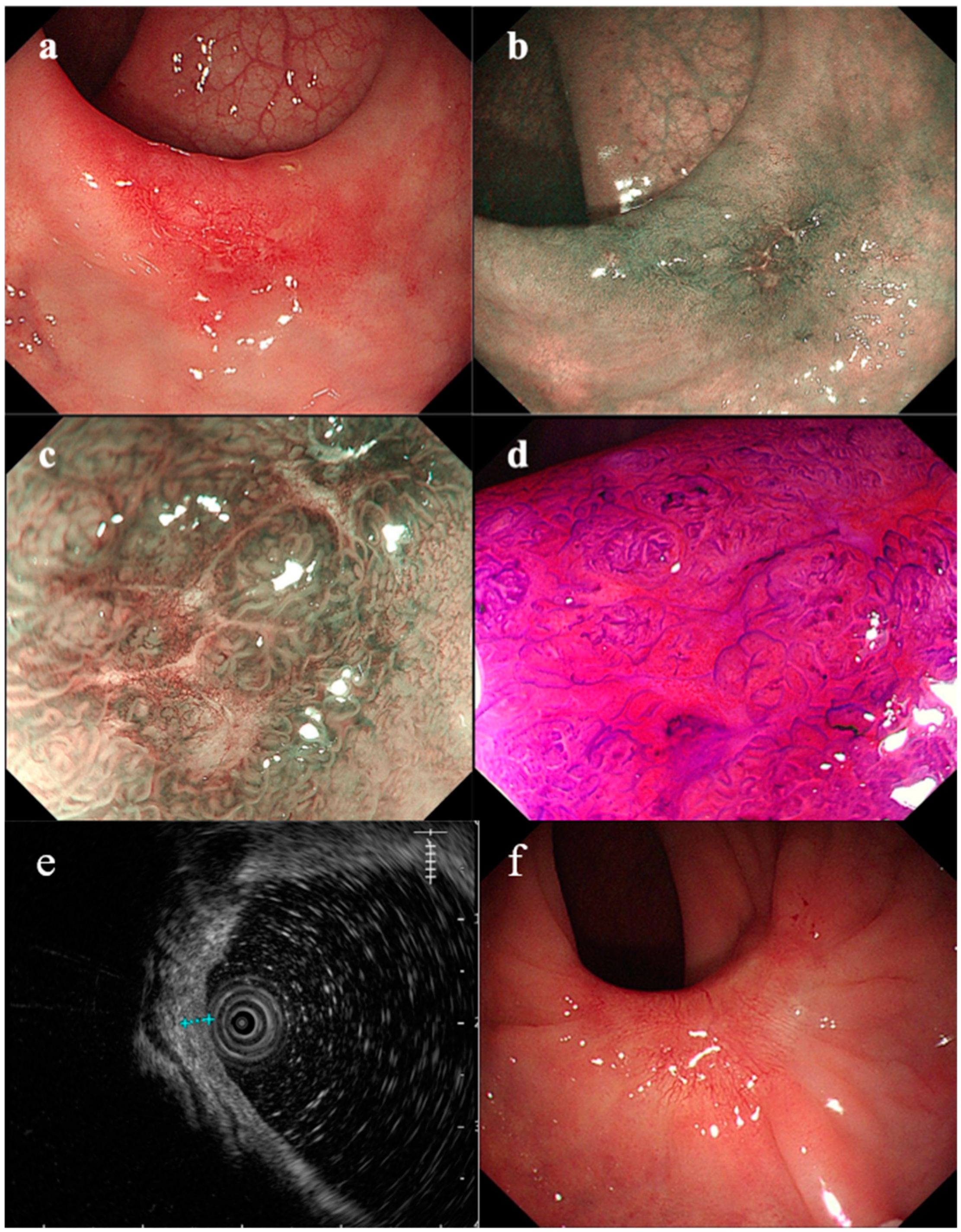 Medicina 58 01136 g001
