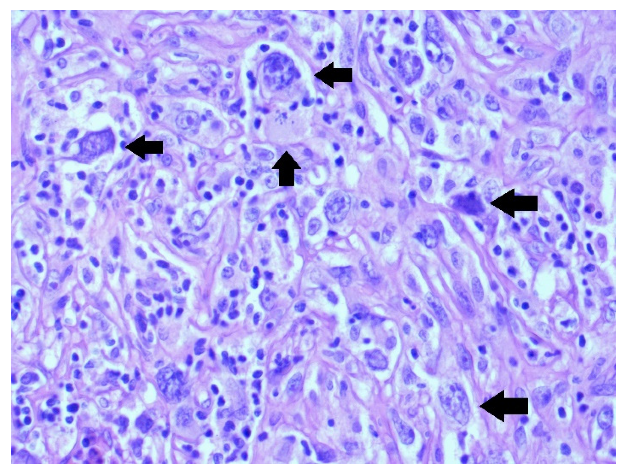 Medicina 58 01141 g004