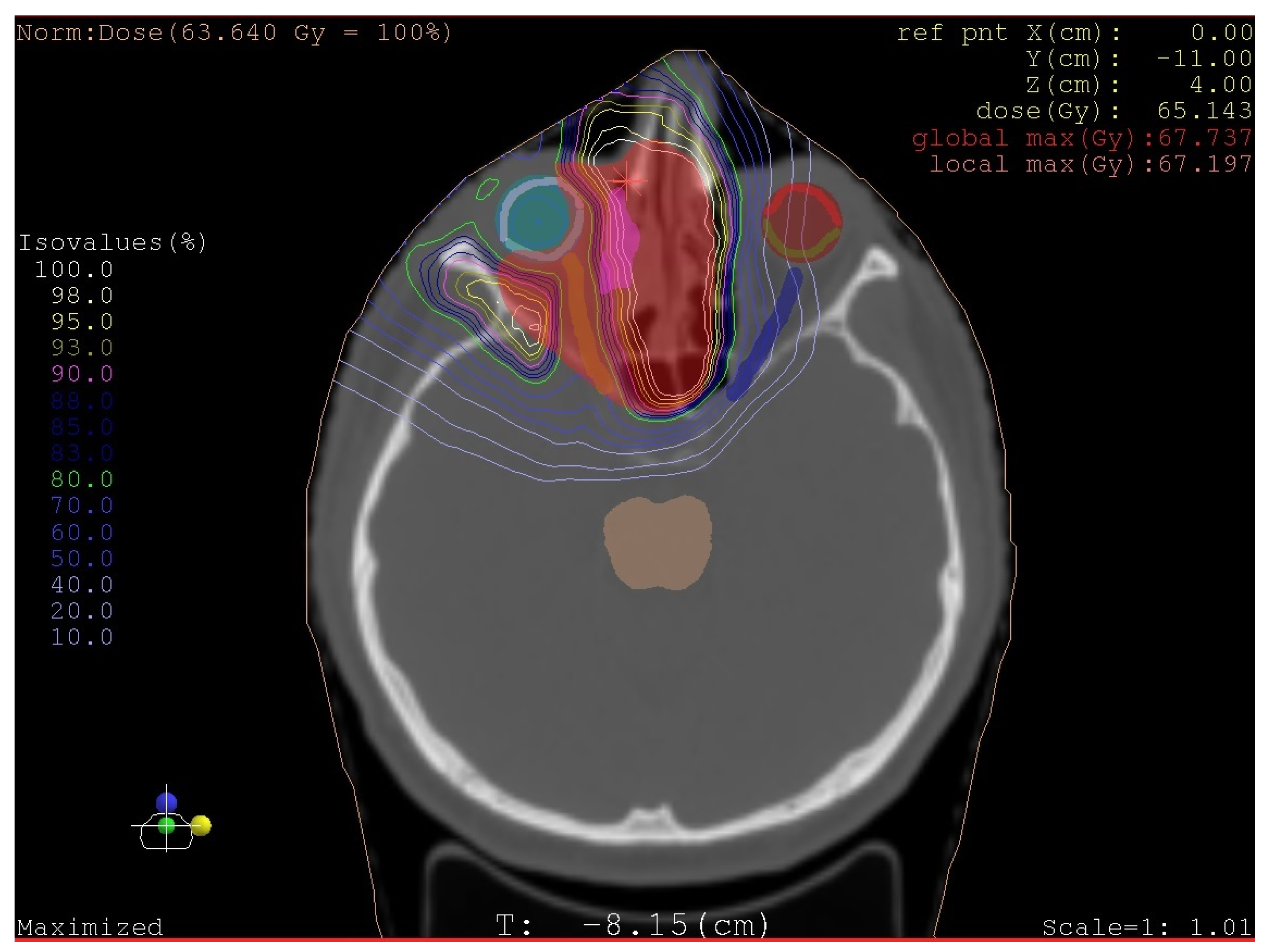 Medicina 58 01141 g005