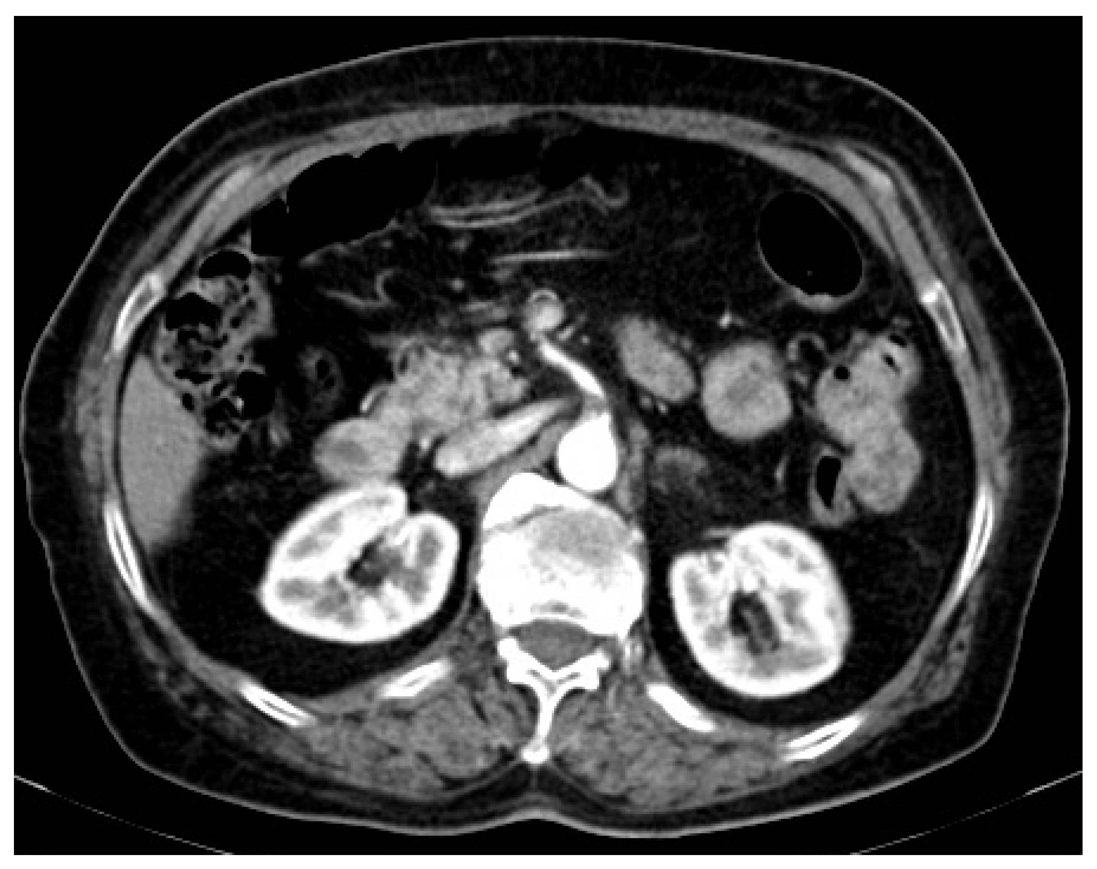 Medicina 58 01147 g002 Medicina 58 01147 g002