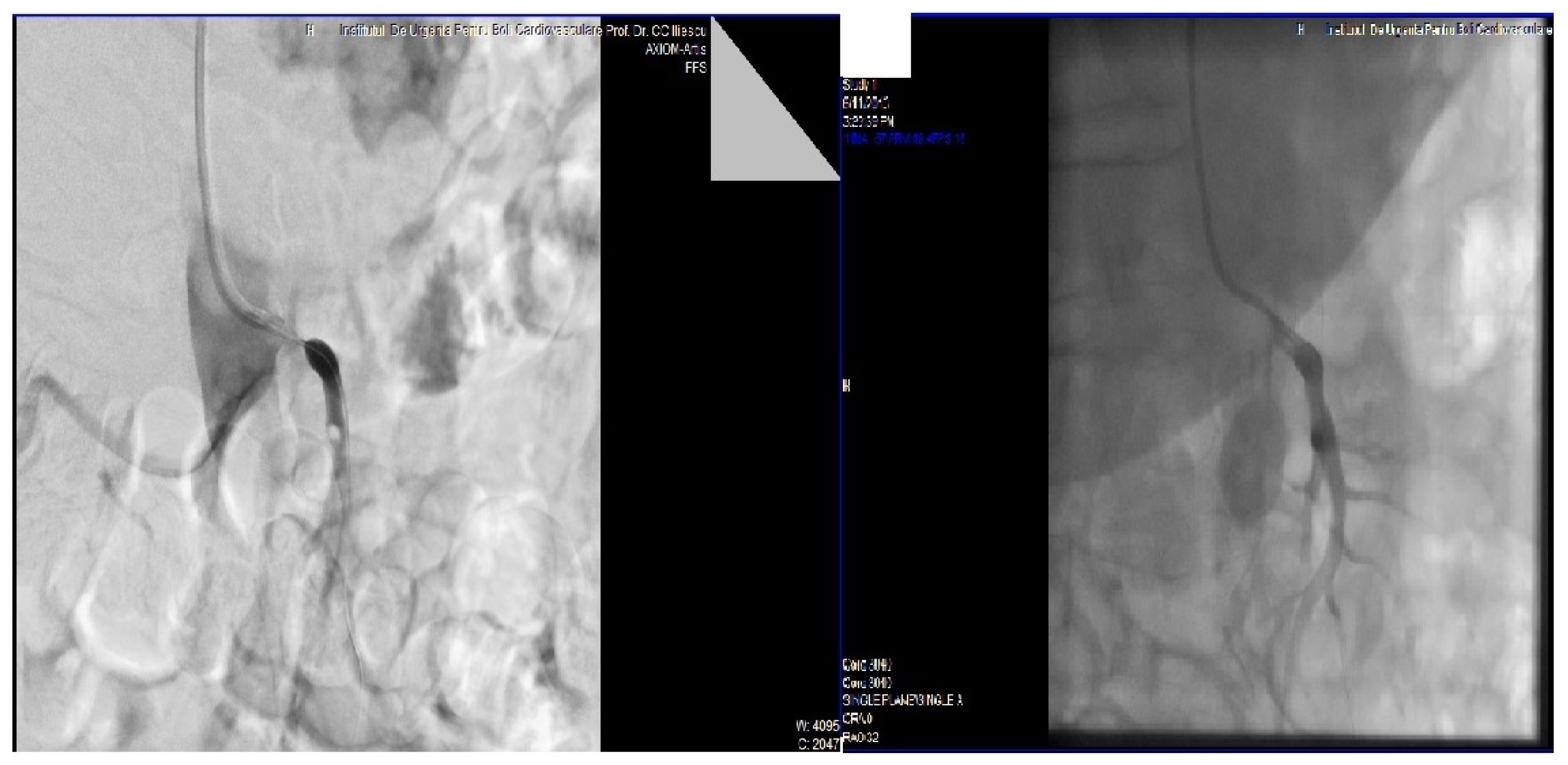 Medicina 58 01147 g003 Medicina 58 01147 g003