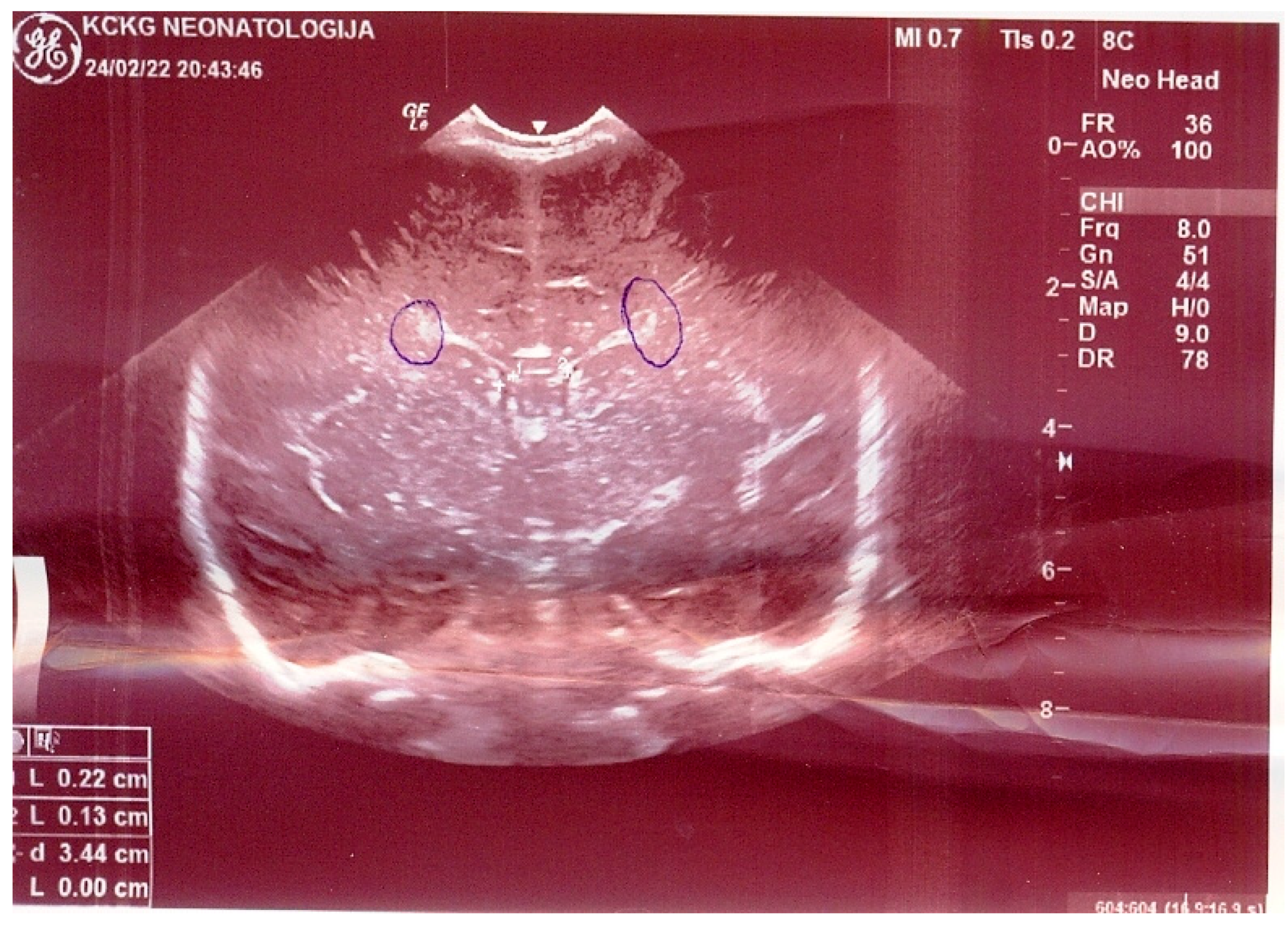 Medicina 58 01150 g002