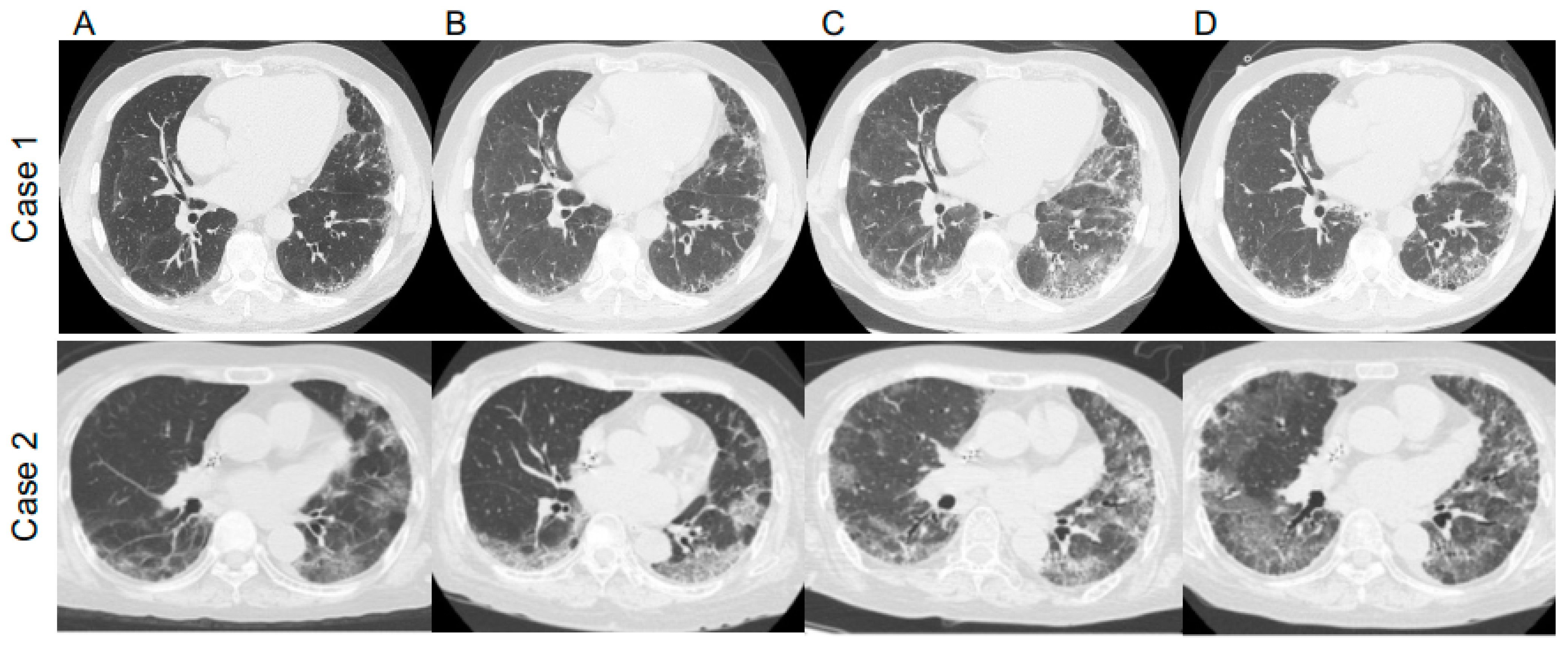 Medicina 58 01151 g002 550
