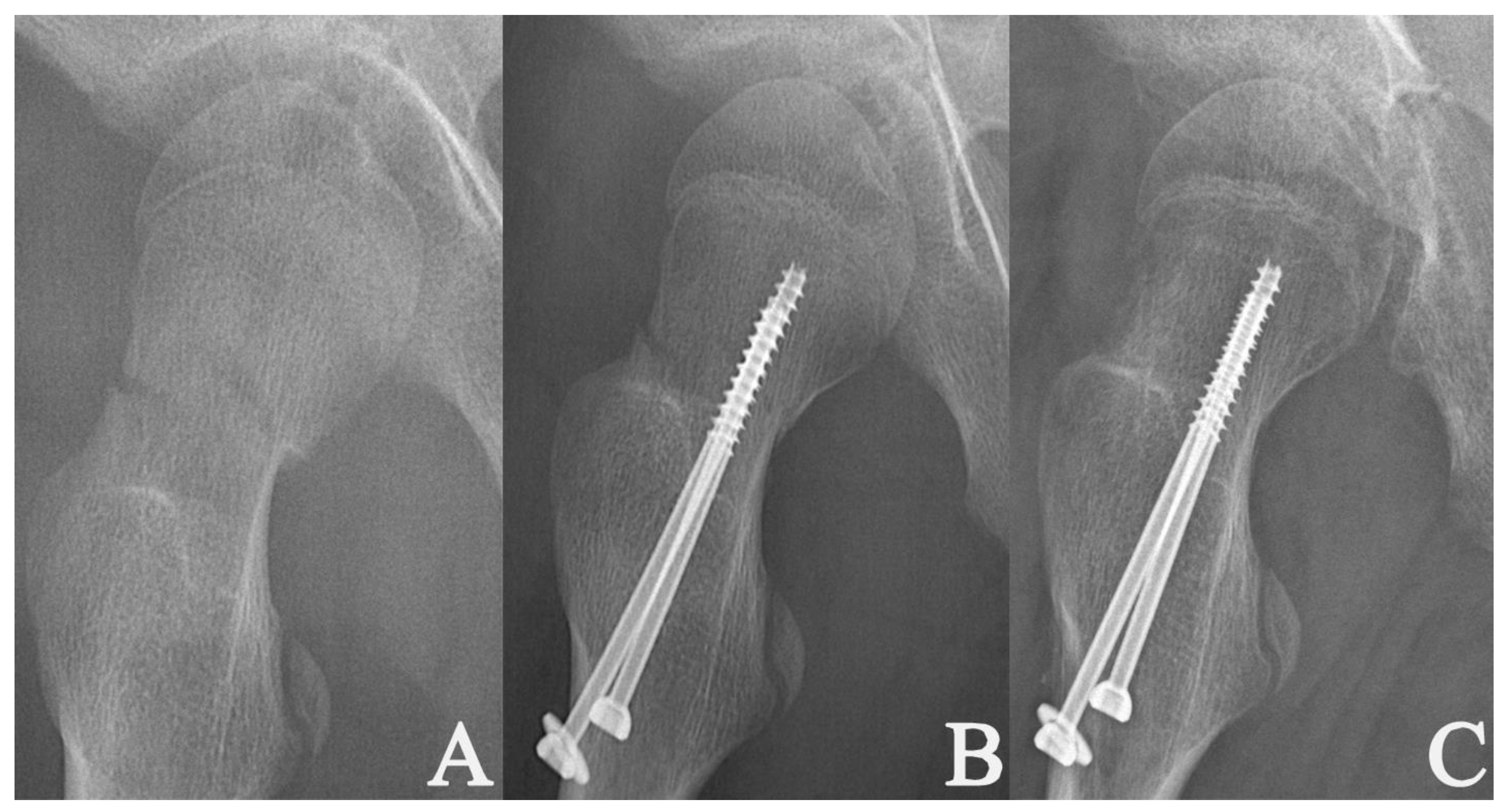 Medicina 58 01153 g003 550