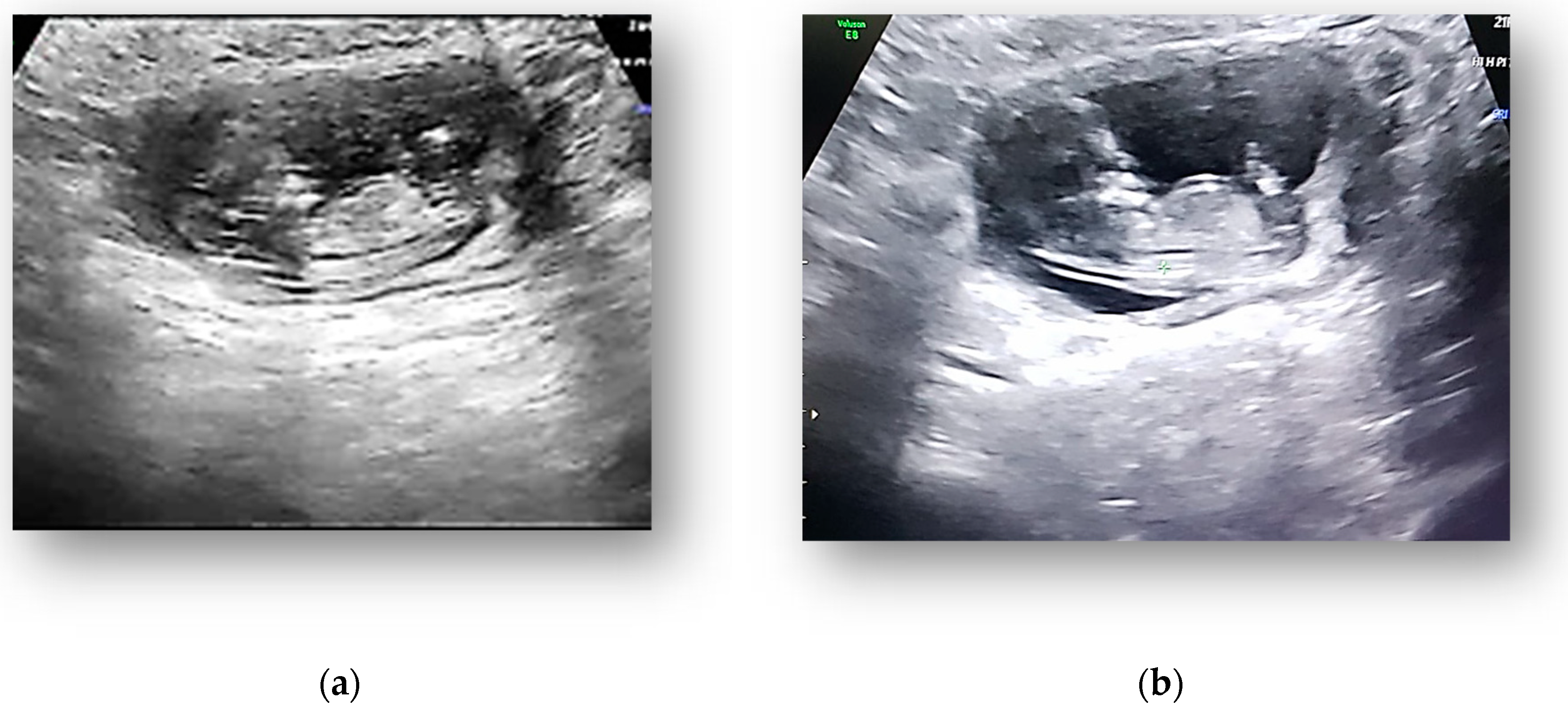 Medicina 58 01160 g002