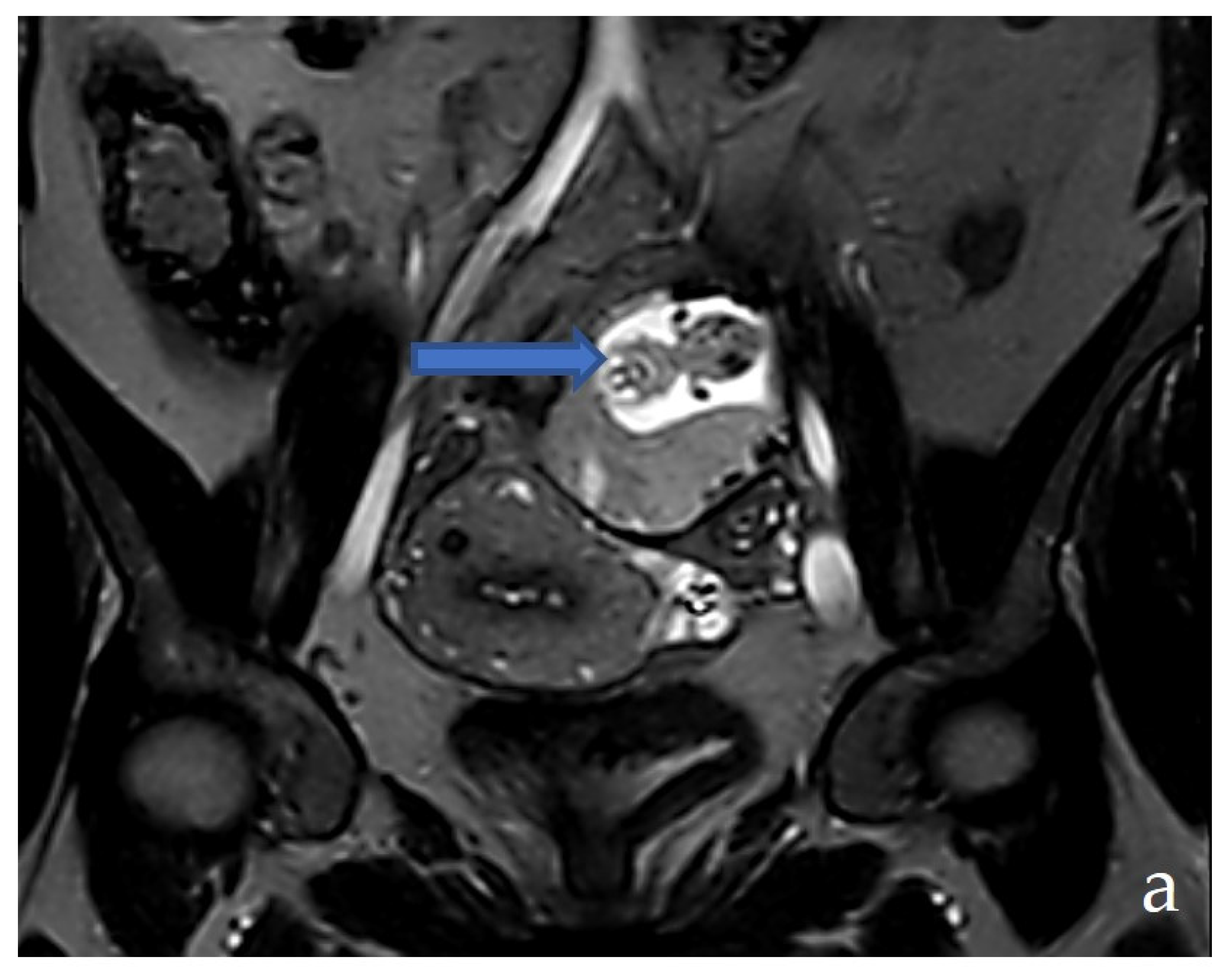 Medicina 58 01160 g004a