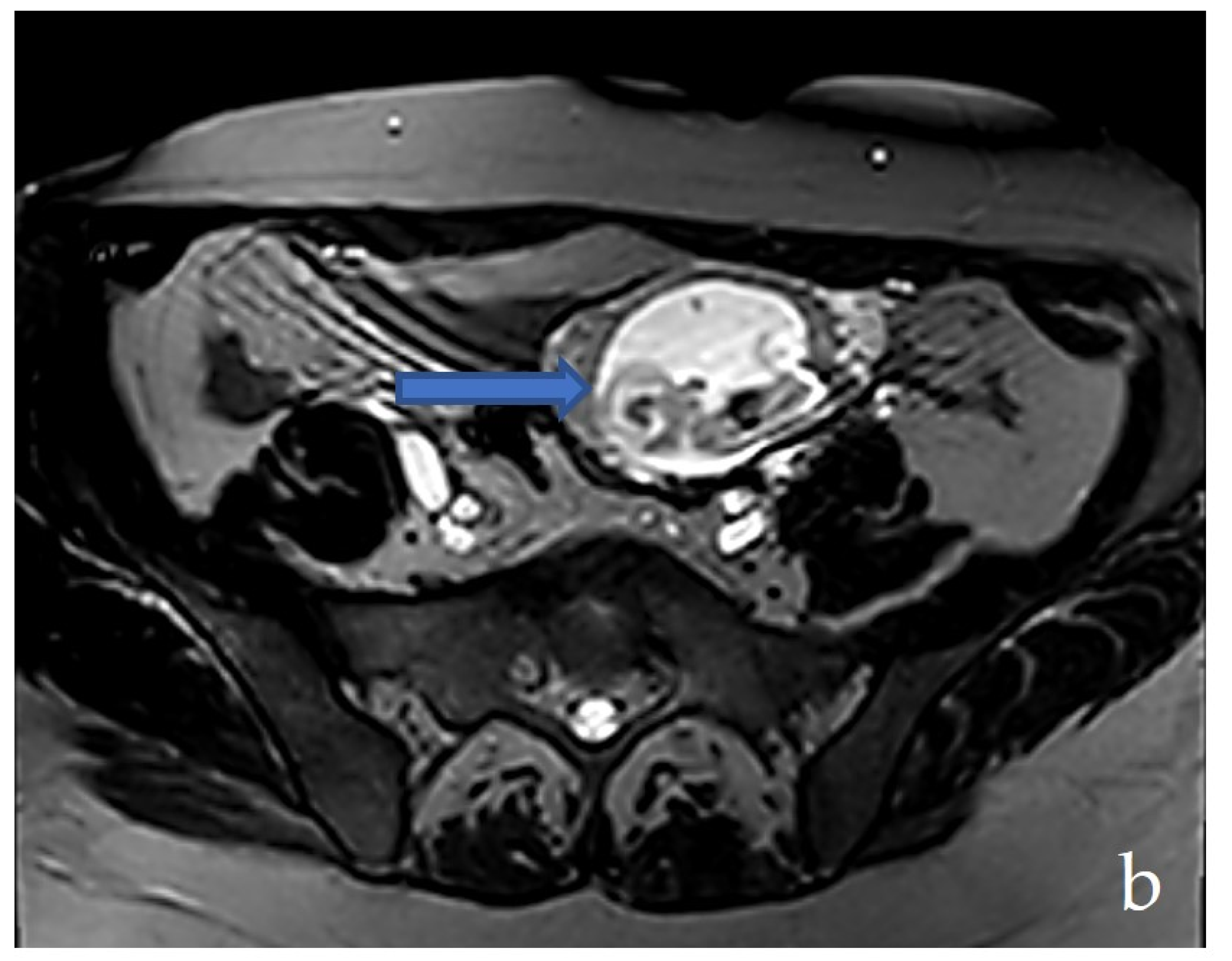 Medicina 58 01160 g004b