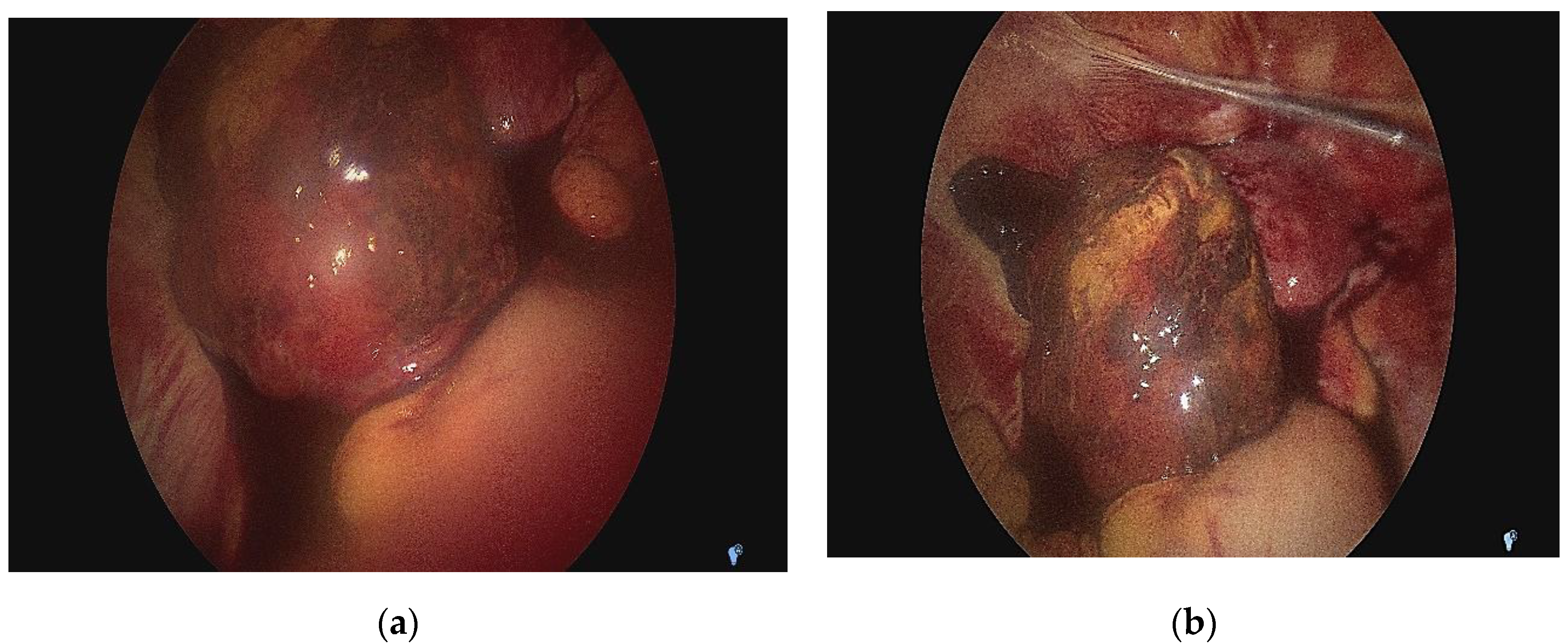 Medicina 58 01160 g005