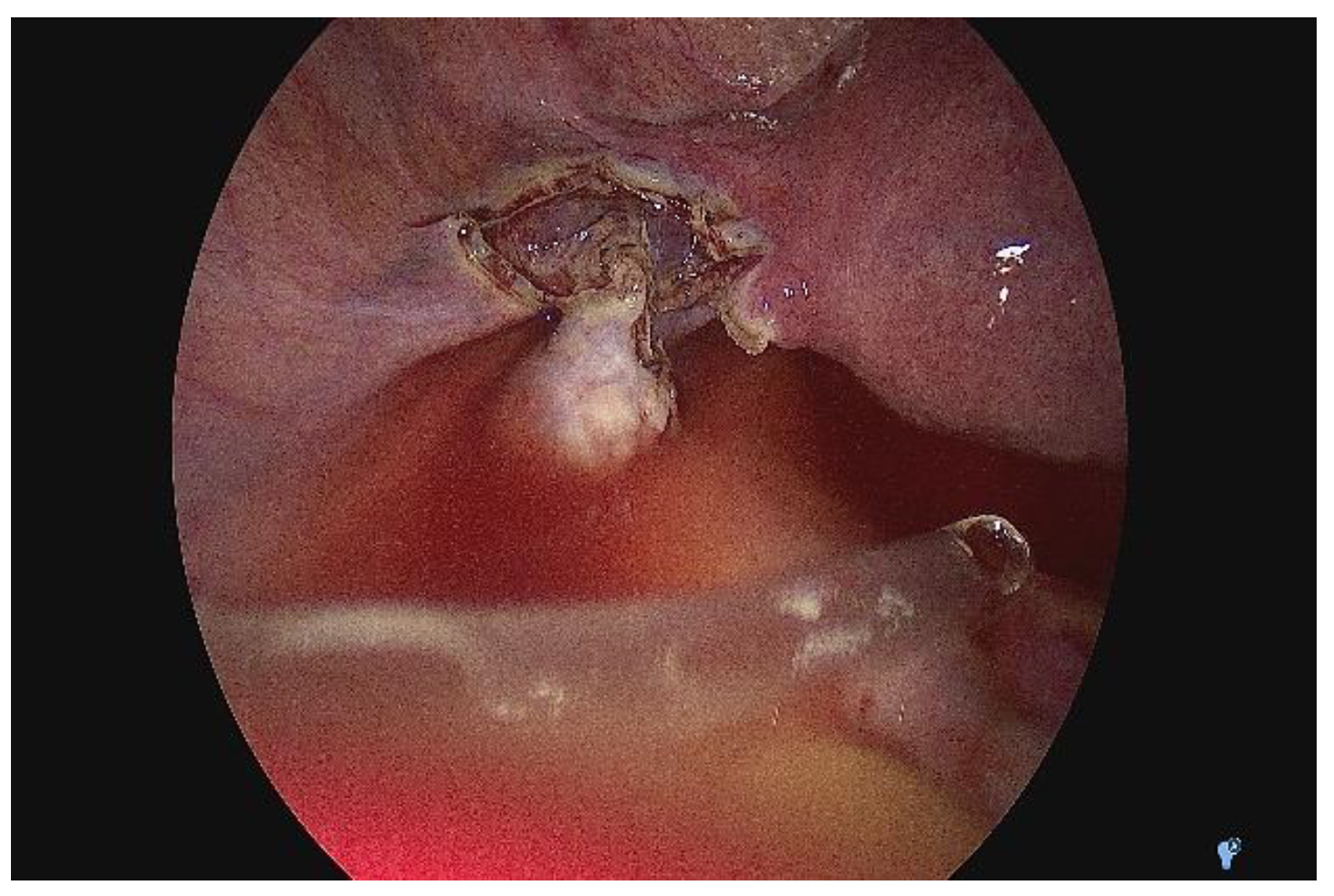 Medicina 58 01160 g006