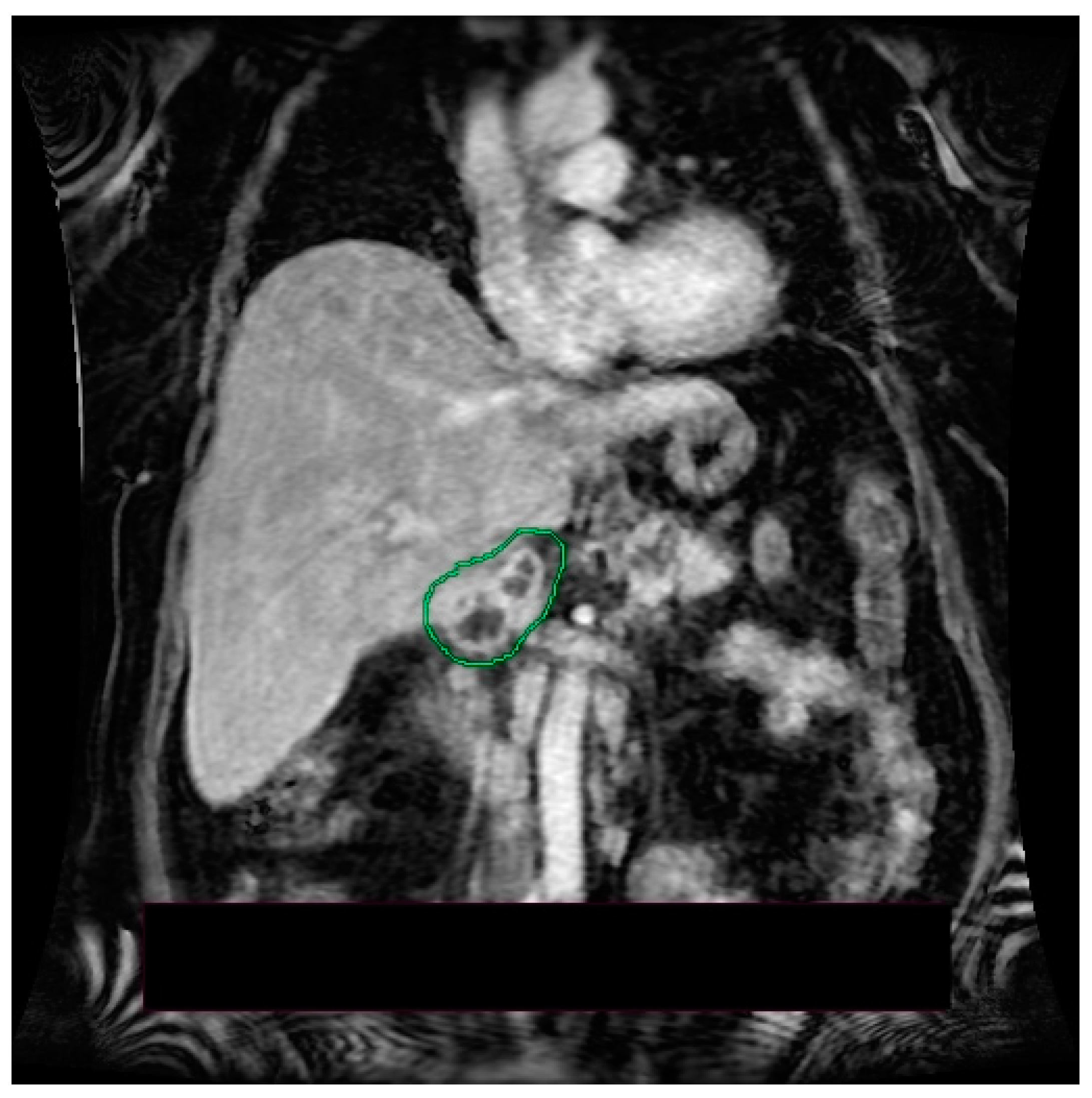 Medicina 58 01165 g003