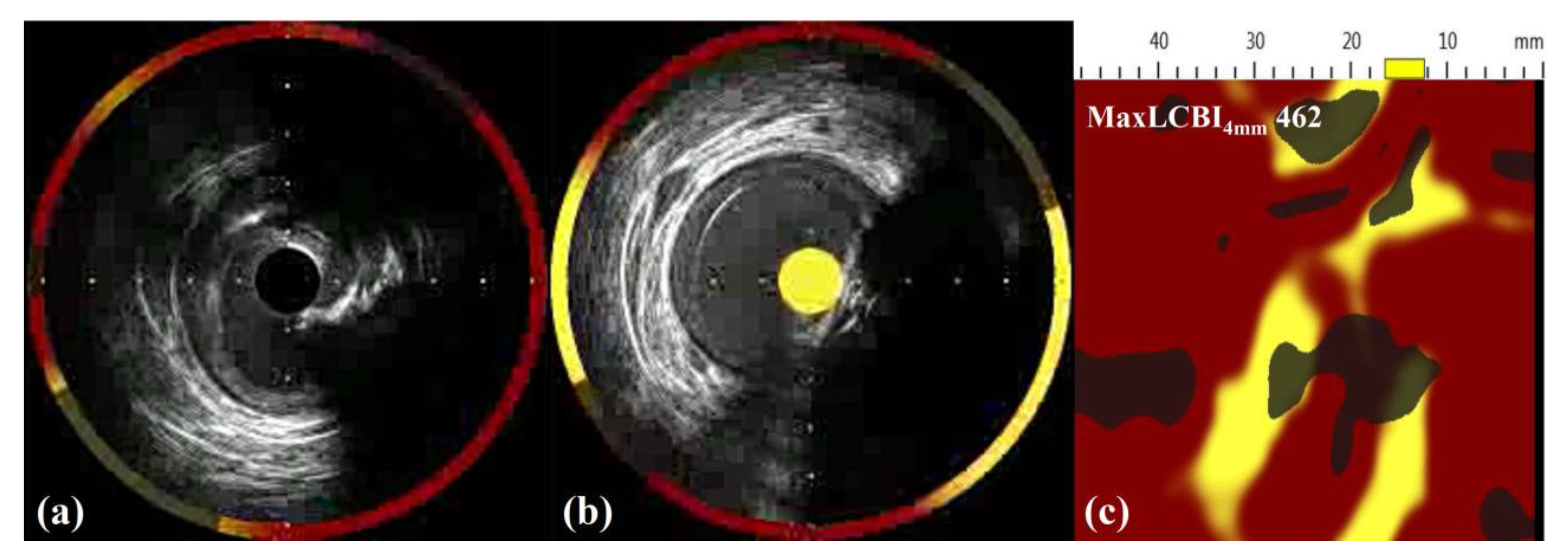 Medicina 58 01166 g002