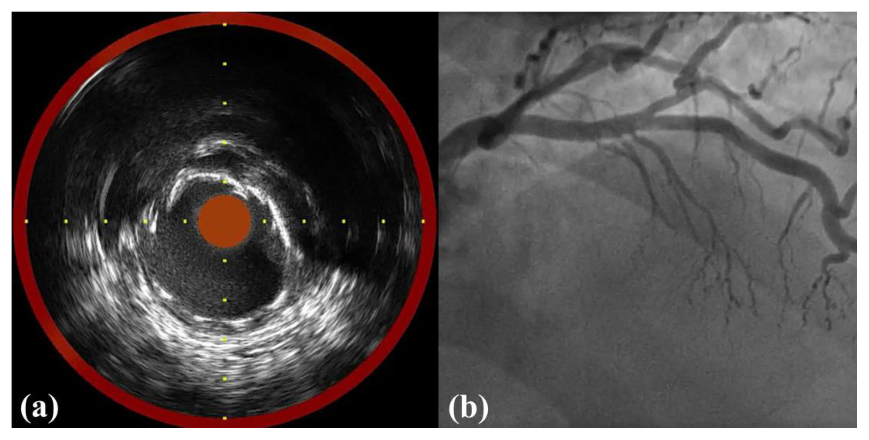 Medicina 58 01166 g003