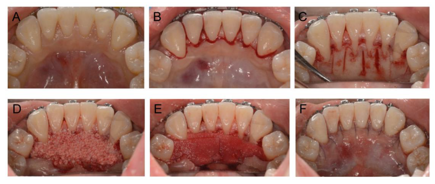 Medicina 58 01181 g004 550