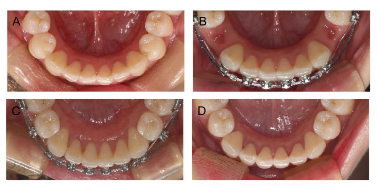 Medicina 58 01181 g005 550