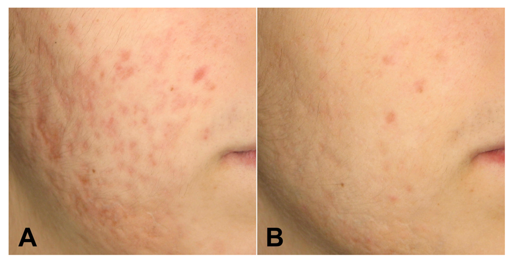 Medicina 58 01190 g002 Medicina 58 01190 g002