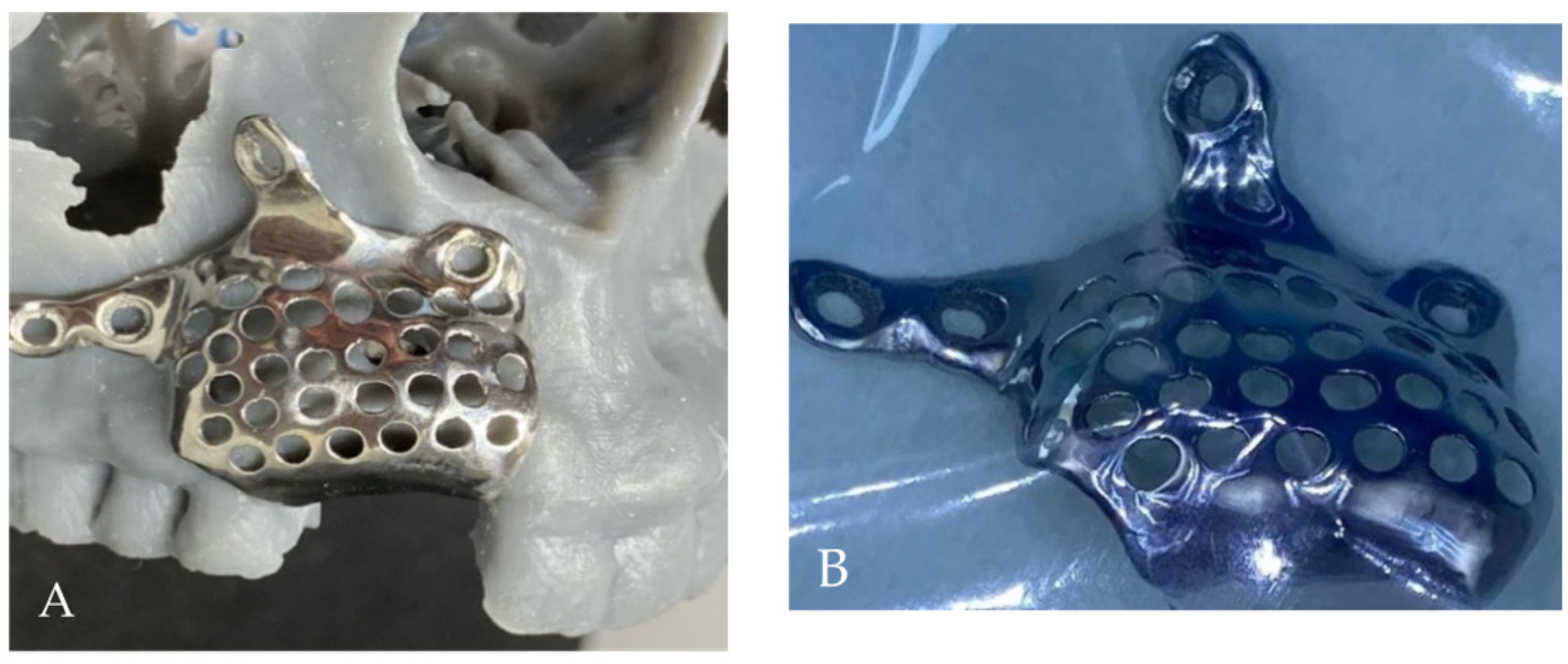 Medicina 58 01192 g005