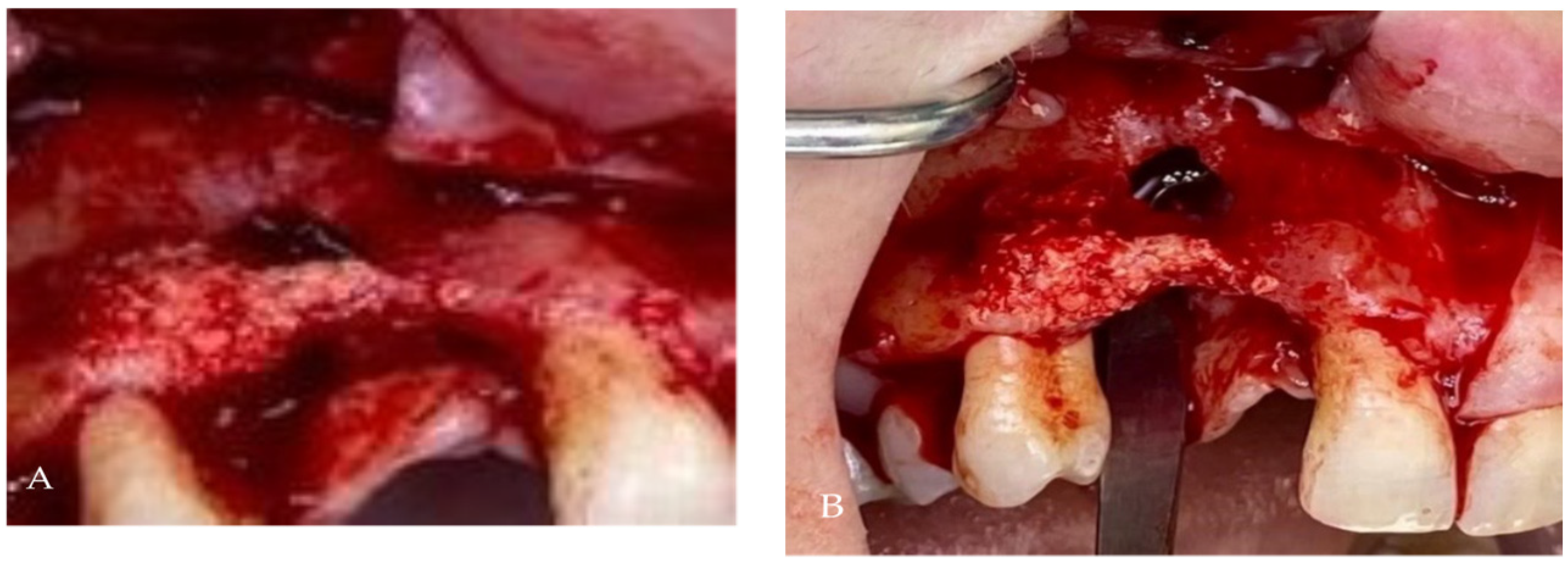 Medicina 58 01192 g006