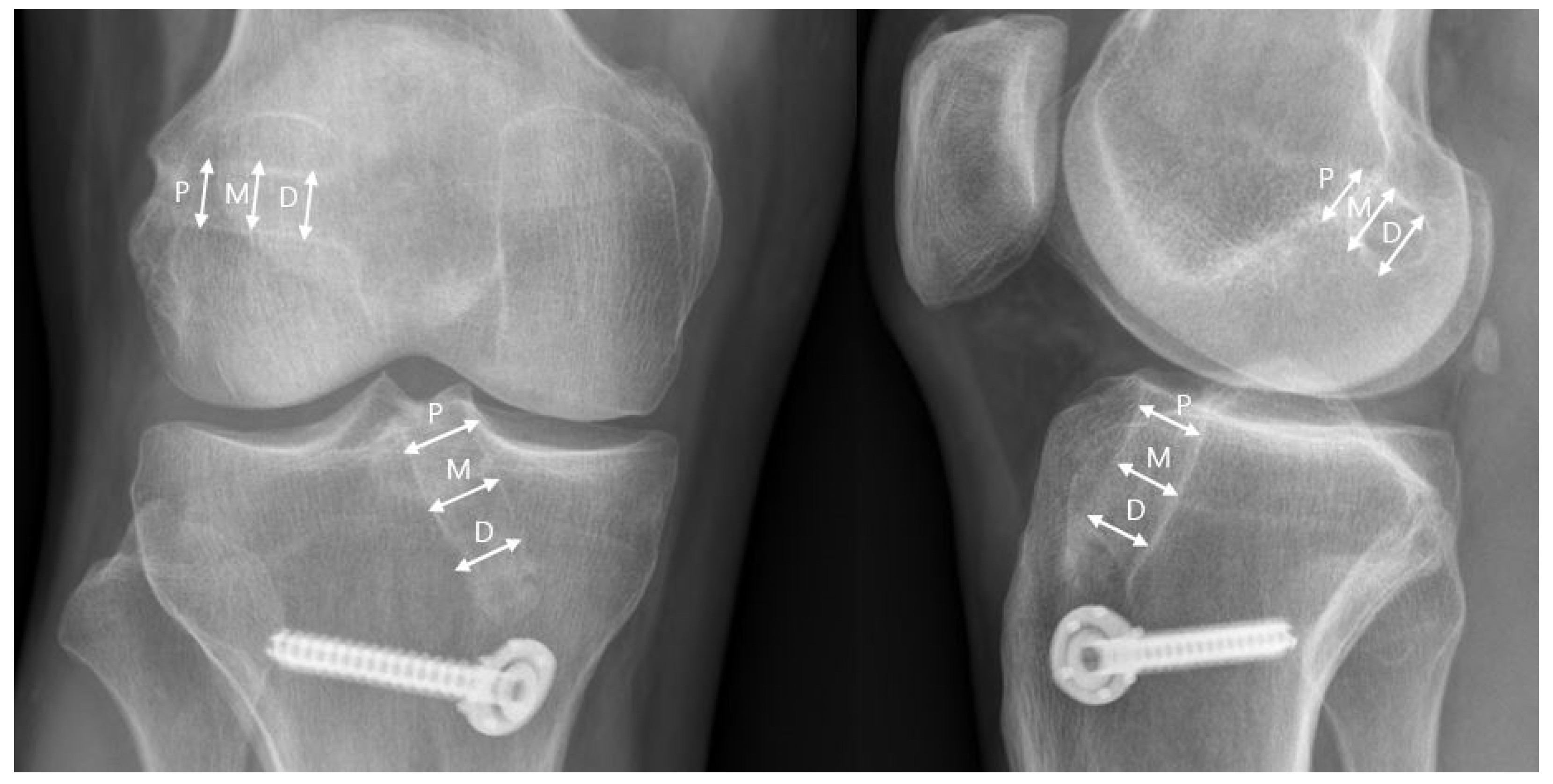 Medicina 58 01193 g003