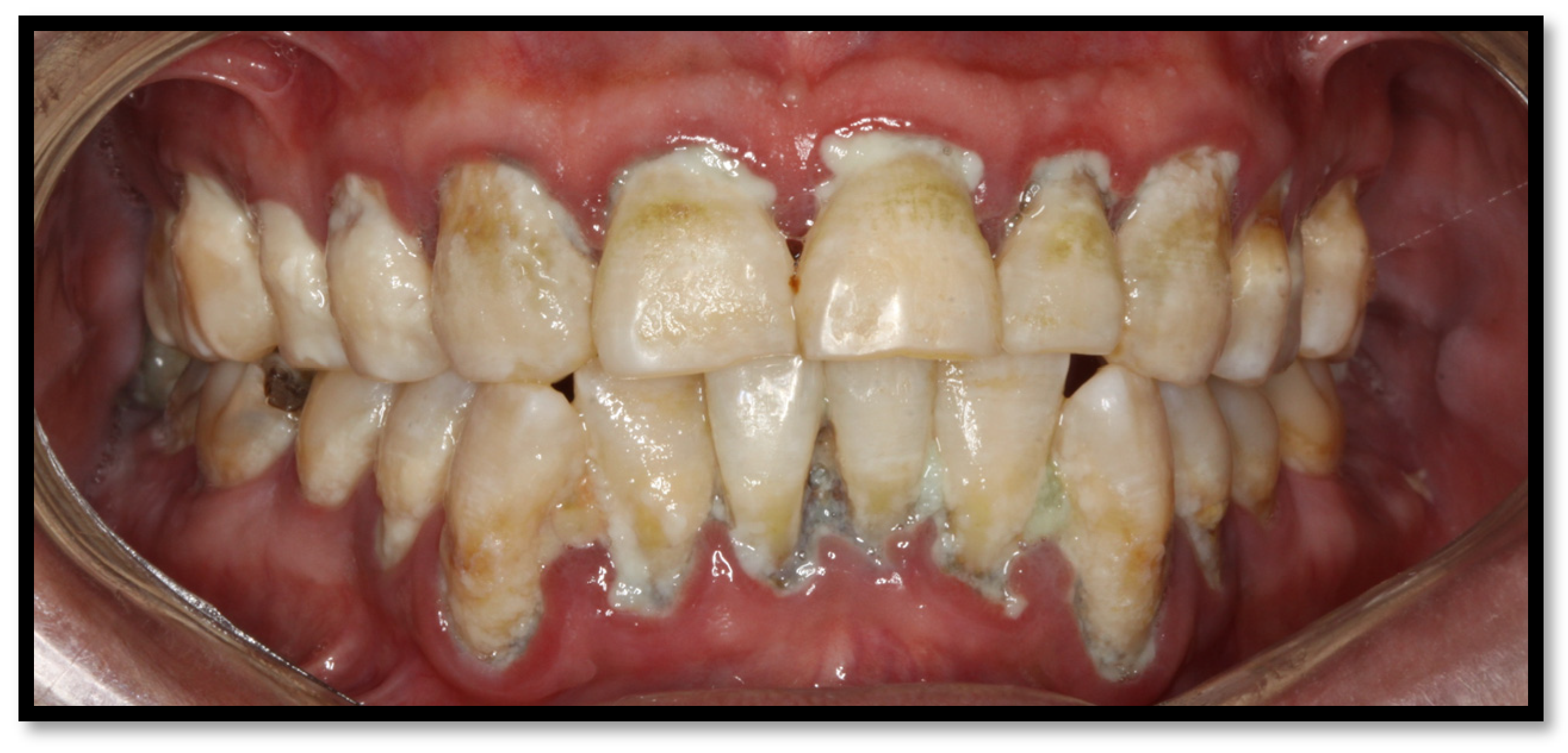 Medicina 58 01214 g006