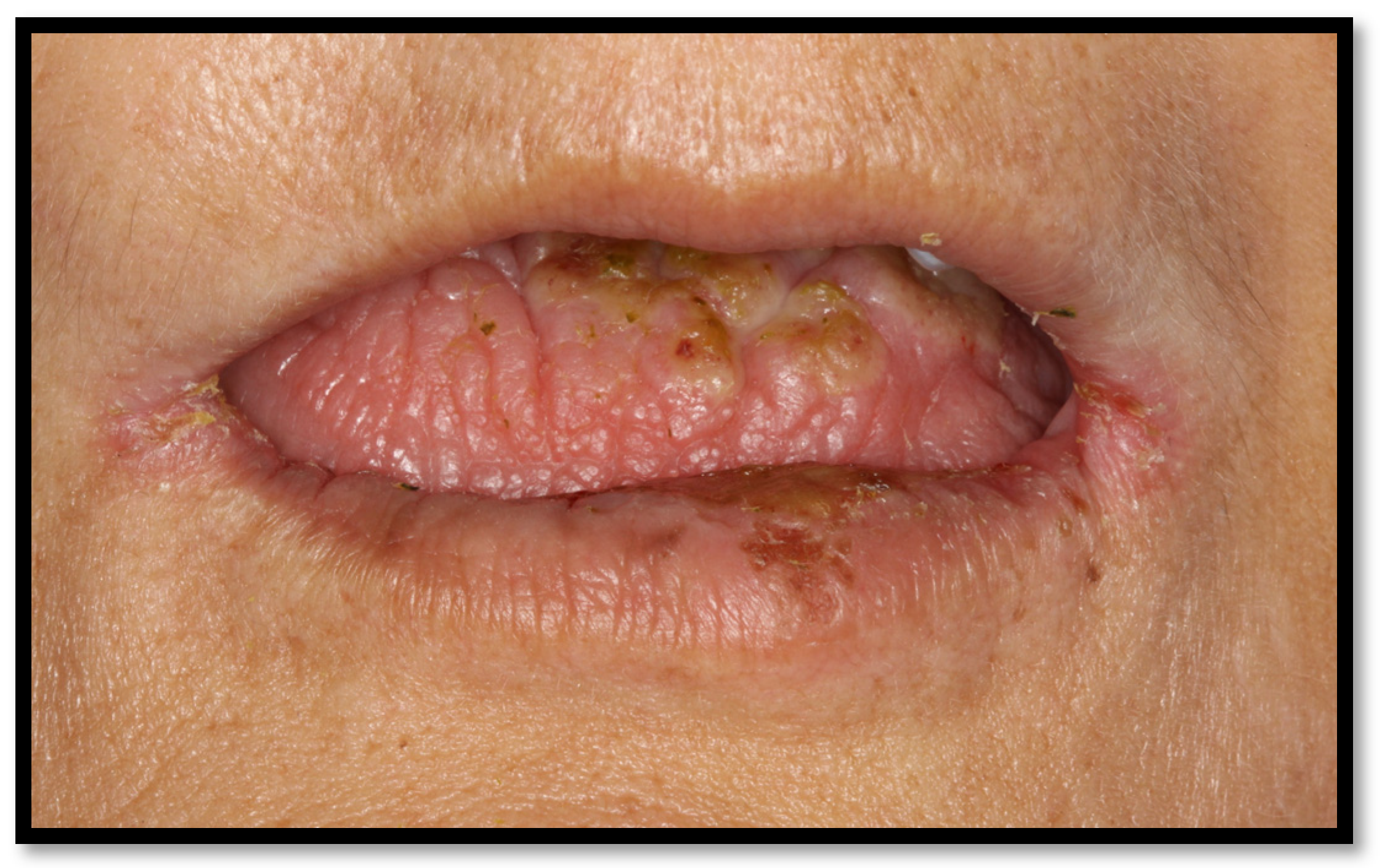 Medicina 58 01214 g007